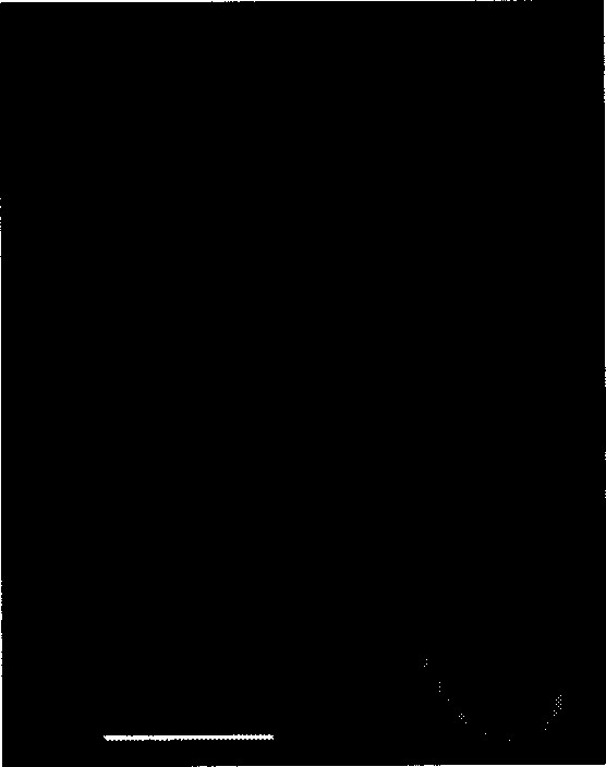 Method for detecting gymnosperm pollen in-tube antigen