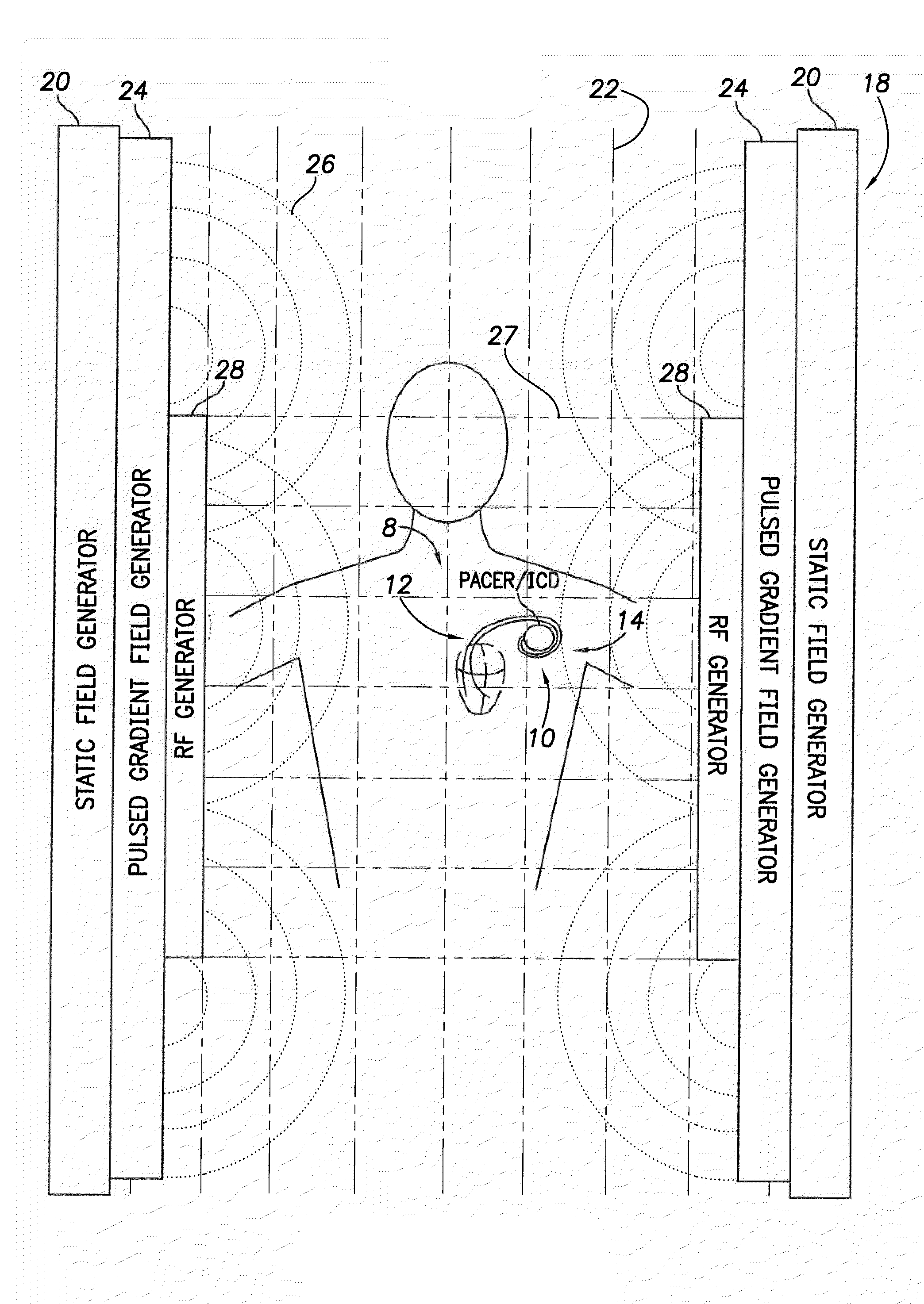 Implantable medical device lead incorporating a conductive sheath surrounding insulated coils to reduce lead heating during MRI