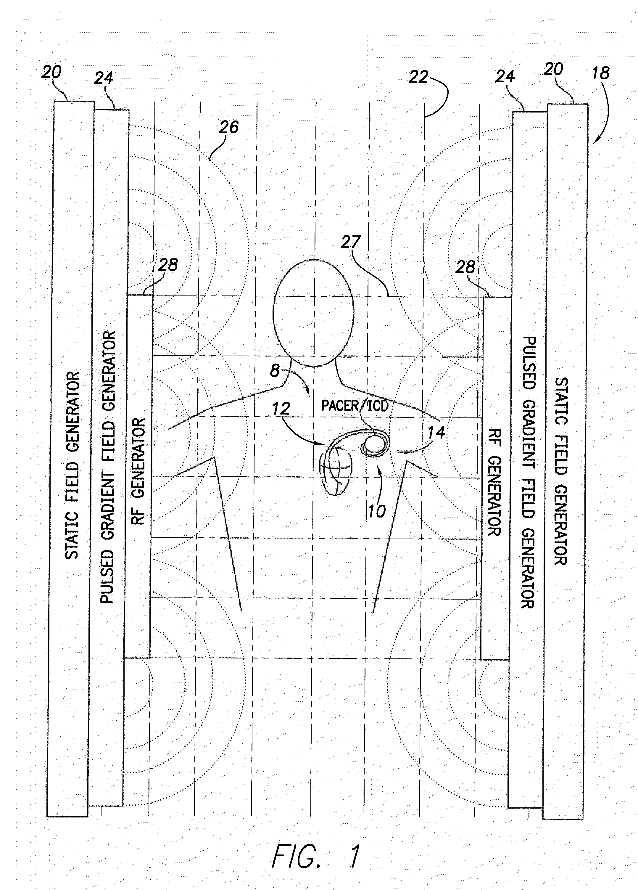 Implantable medical device lead incorporating a conductive sheath surrounding insulated coils to reduce lead heating during MRI