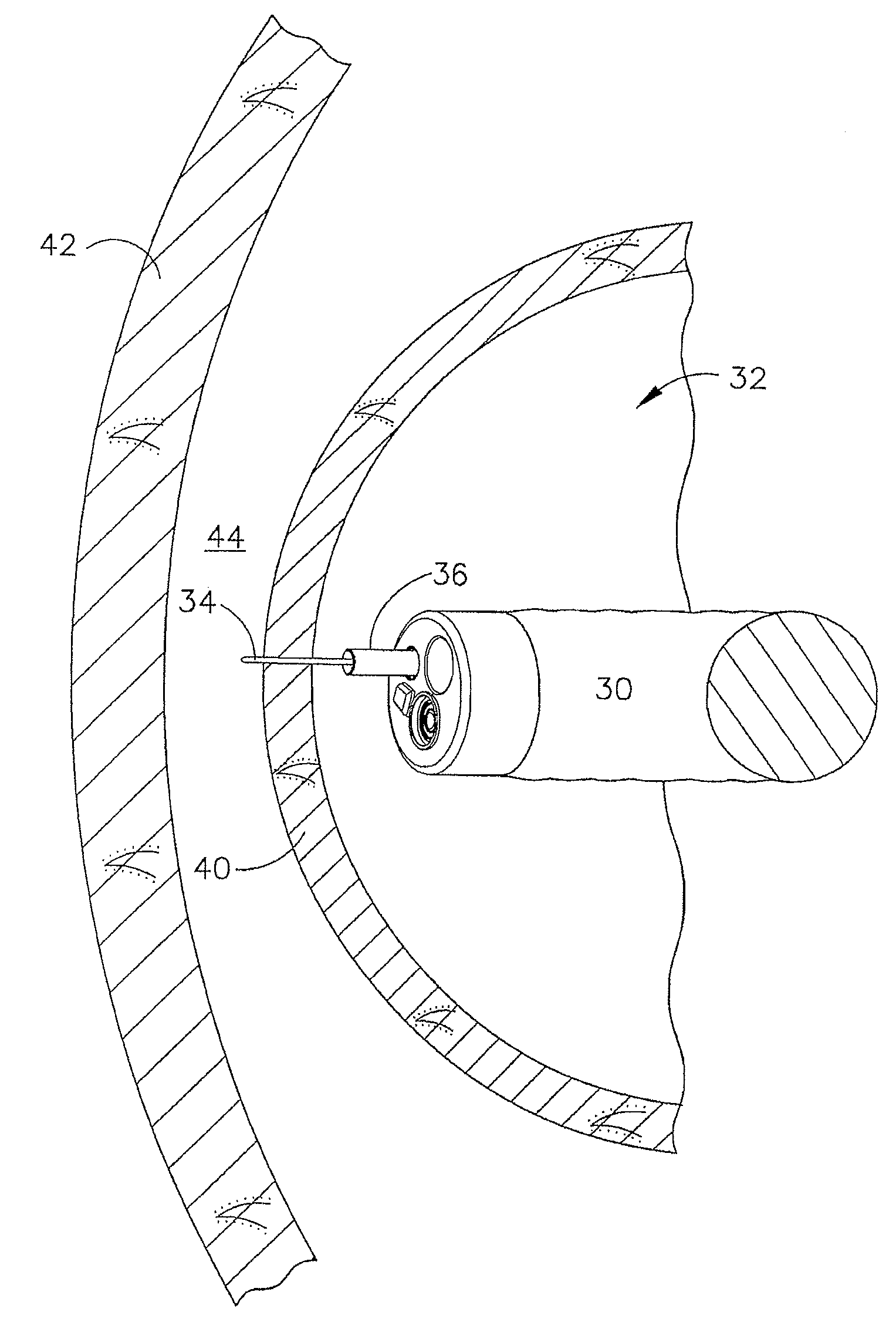 Device for insufflating the interior of a gastric cavity of a patient