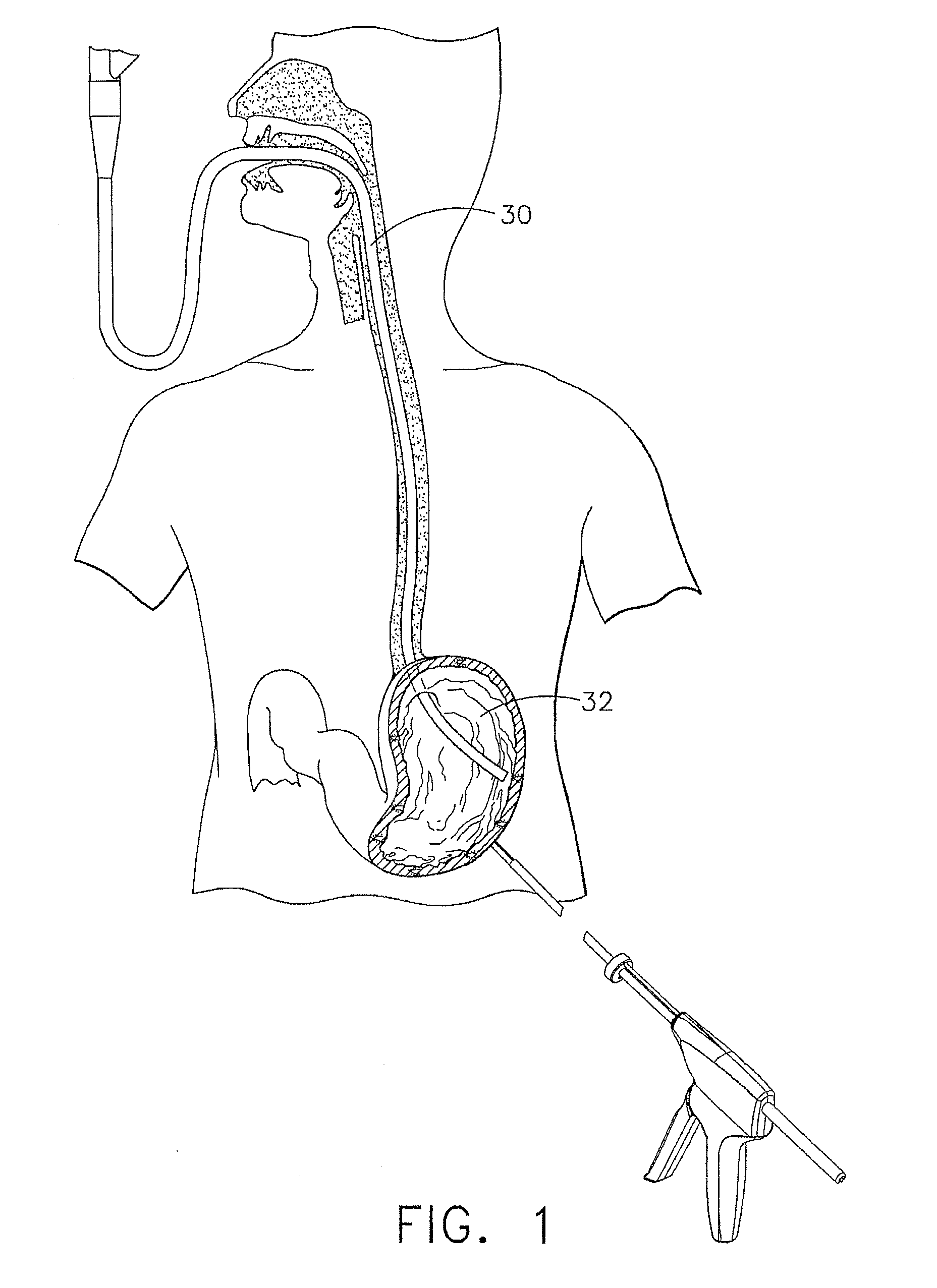 Device for insufflating the interior of a gastric cavity of a patient