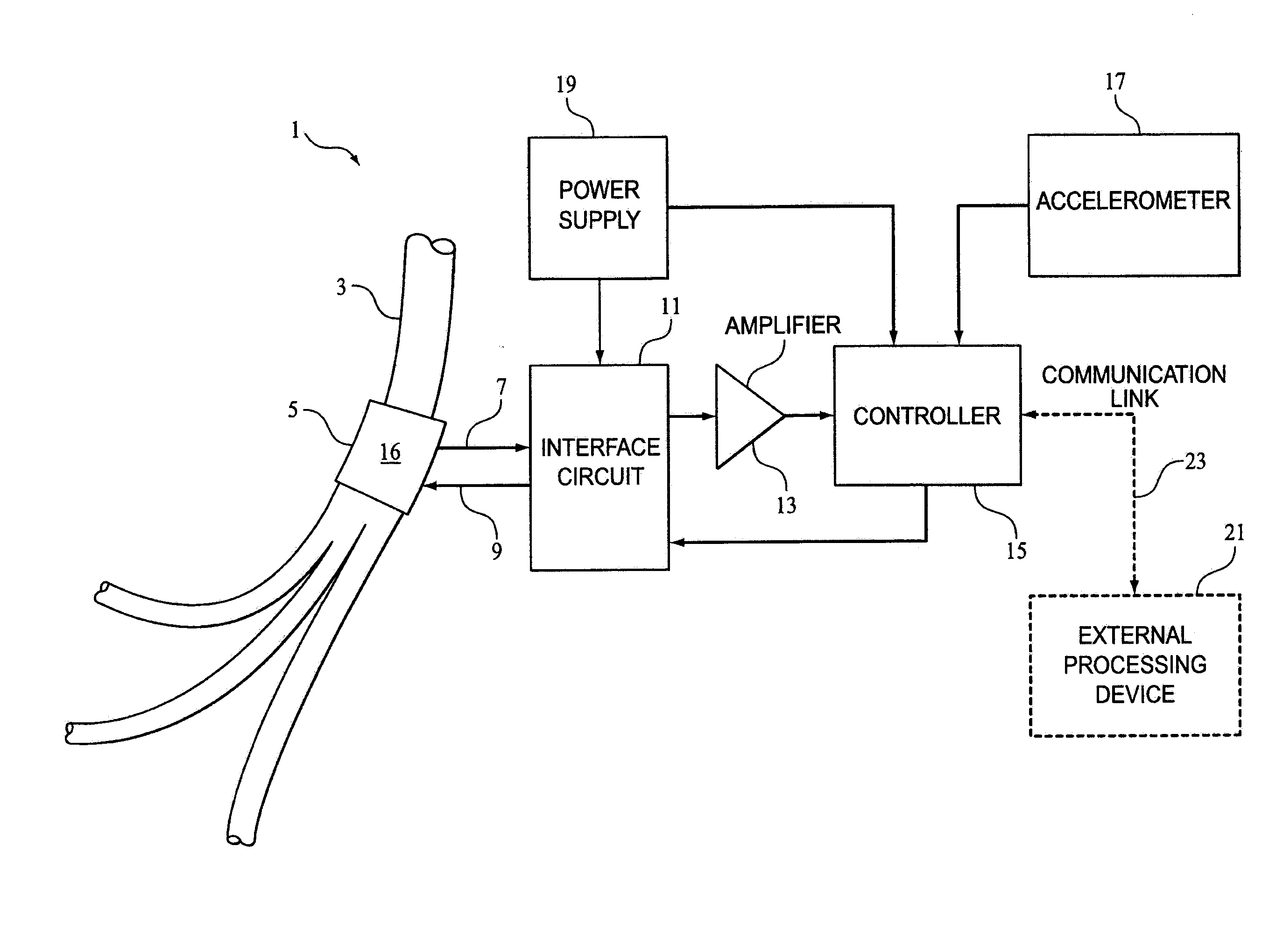 Method and Apparatus for Hypoglossal Nerve Stimulation