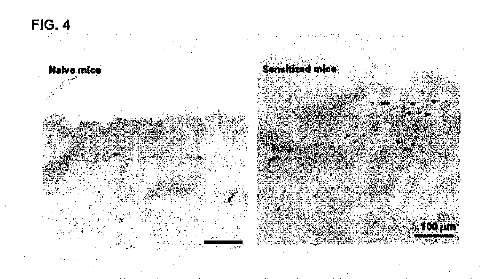 Biomarker of allergic disease and use of the same