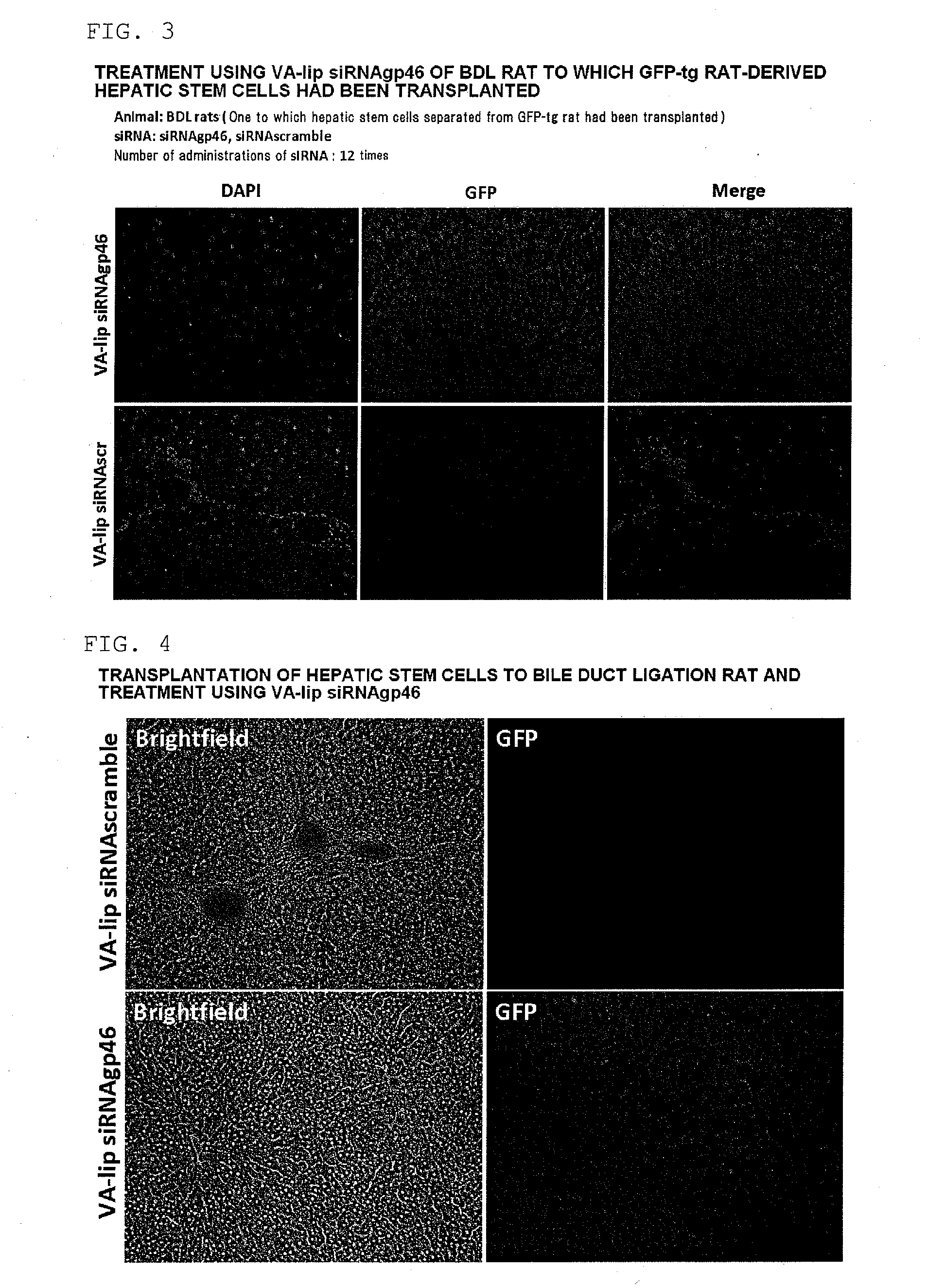 Composition for regenerating normal tissue from fibrotic tissue