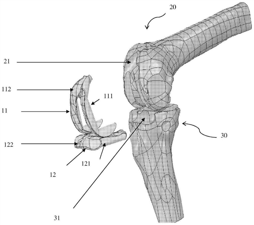 Method for producing a tailor-made implant