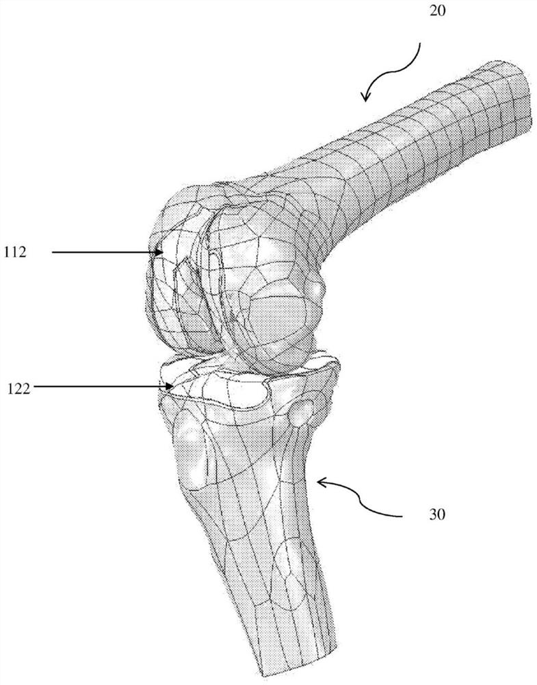 Method for producing a tailor-made implant