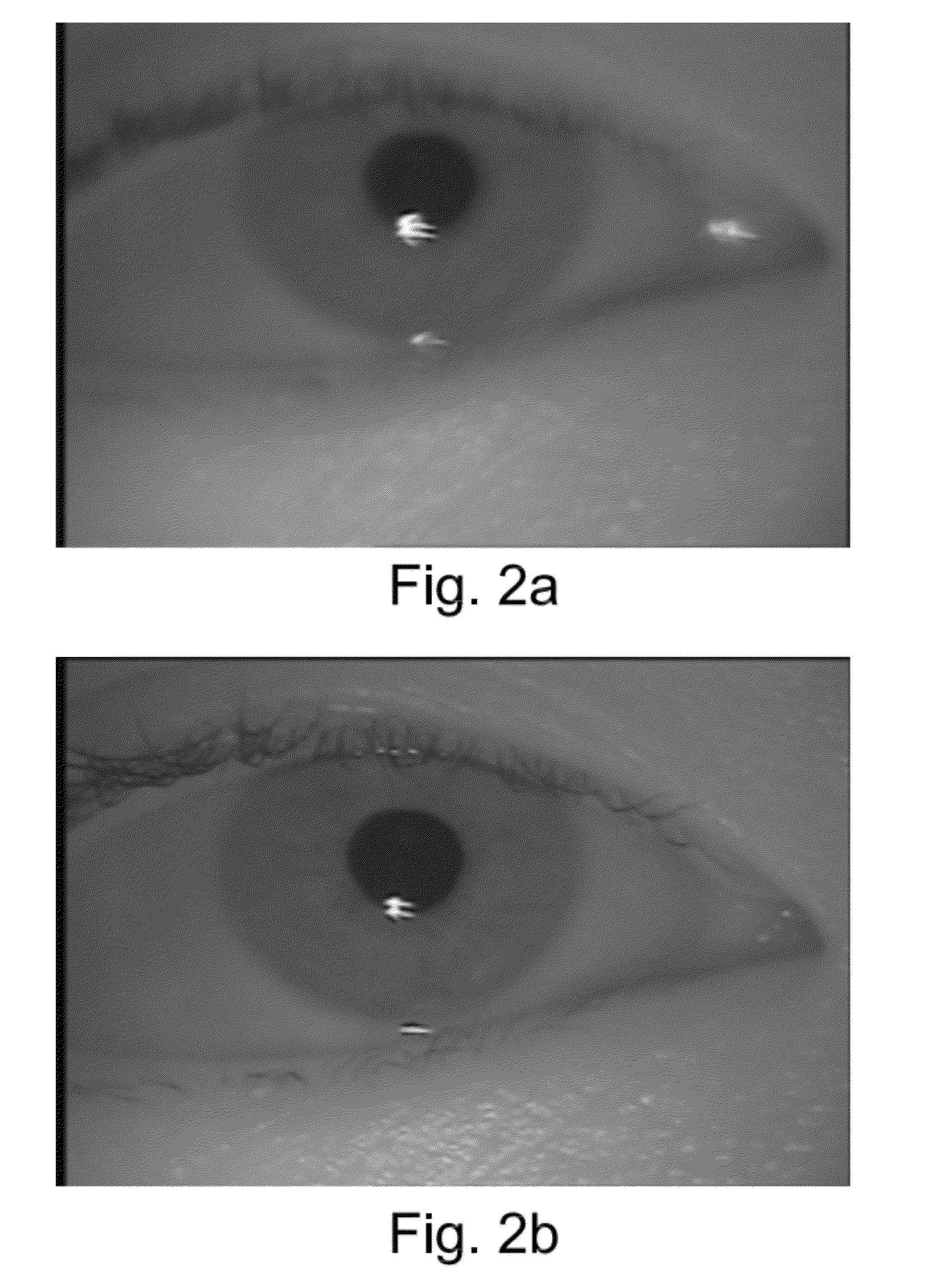 Iris image definition estimation system using the astigmatism of the corneal reflection of a non-coaxial light source