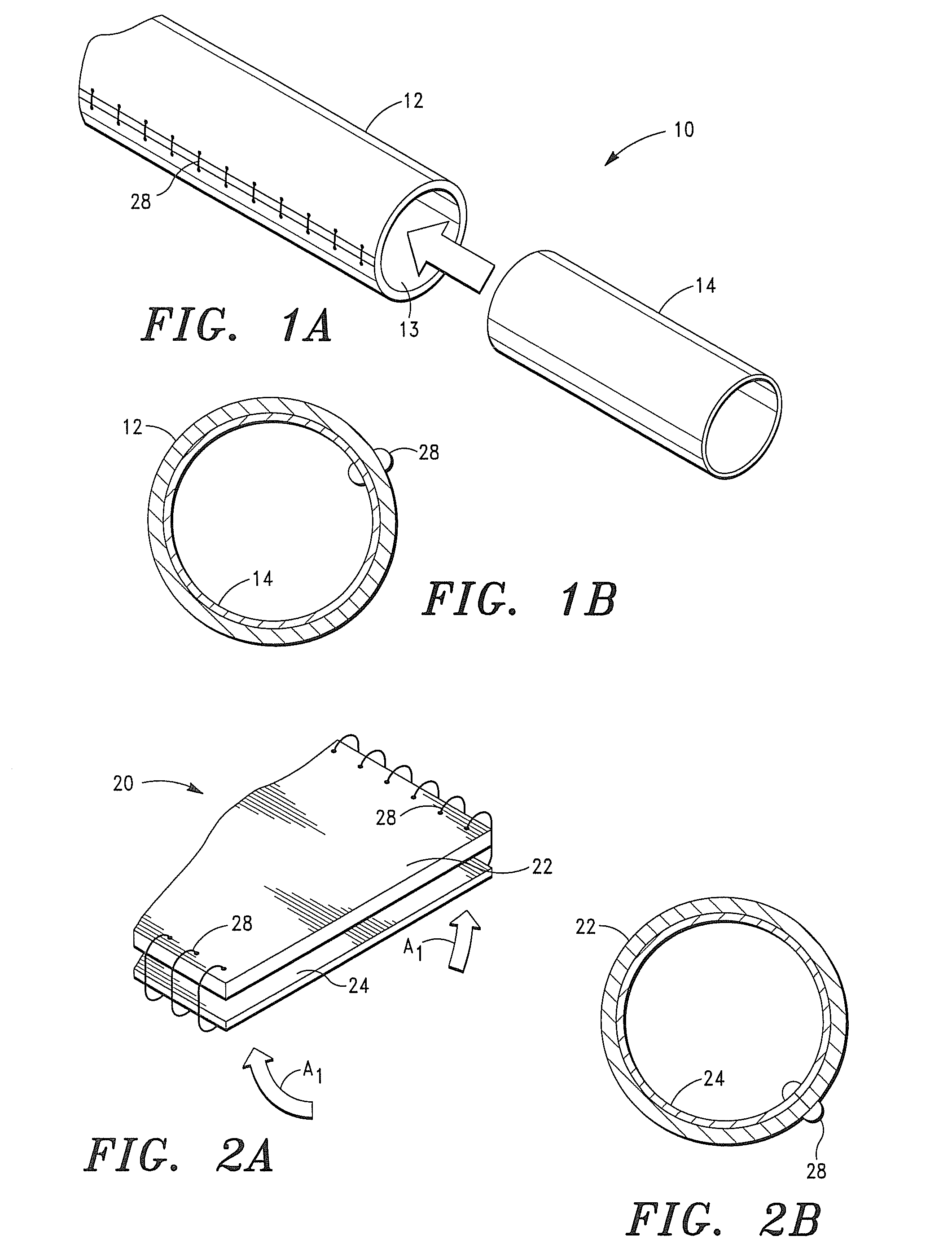 Multi-Layer Vascular Prosthesis