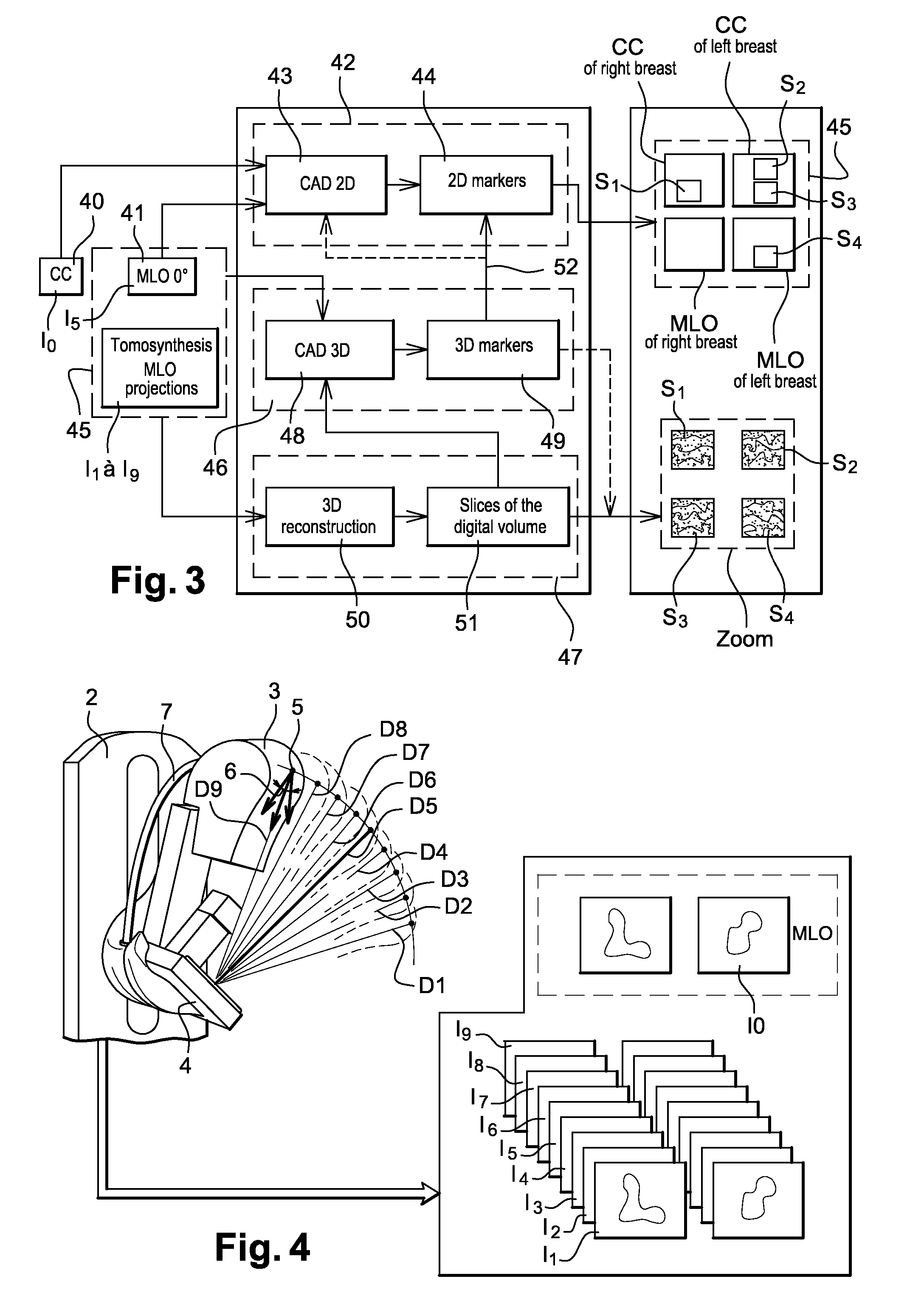 X-ray device and image-processing method