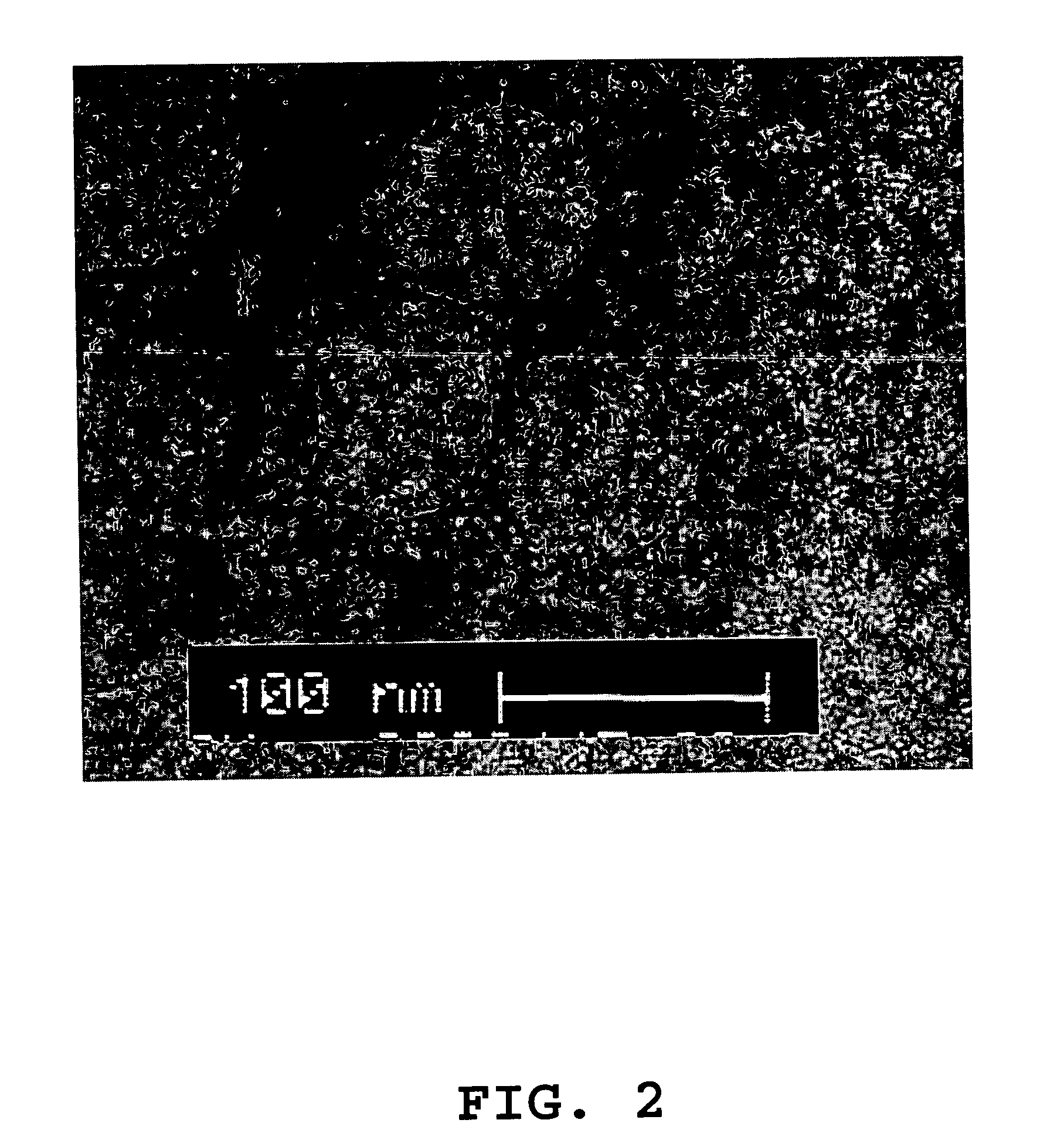 Novel human virus causing severe acute respiratory syndrome (SARS) and uses thereof