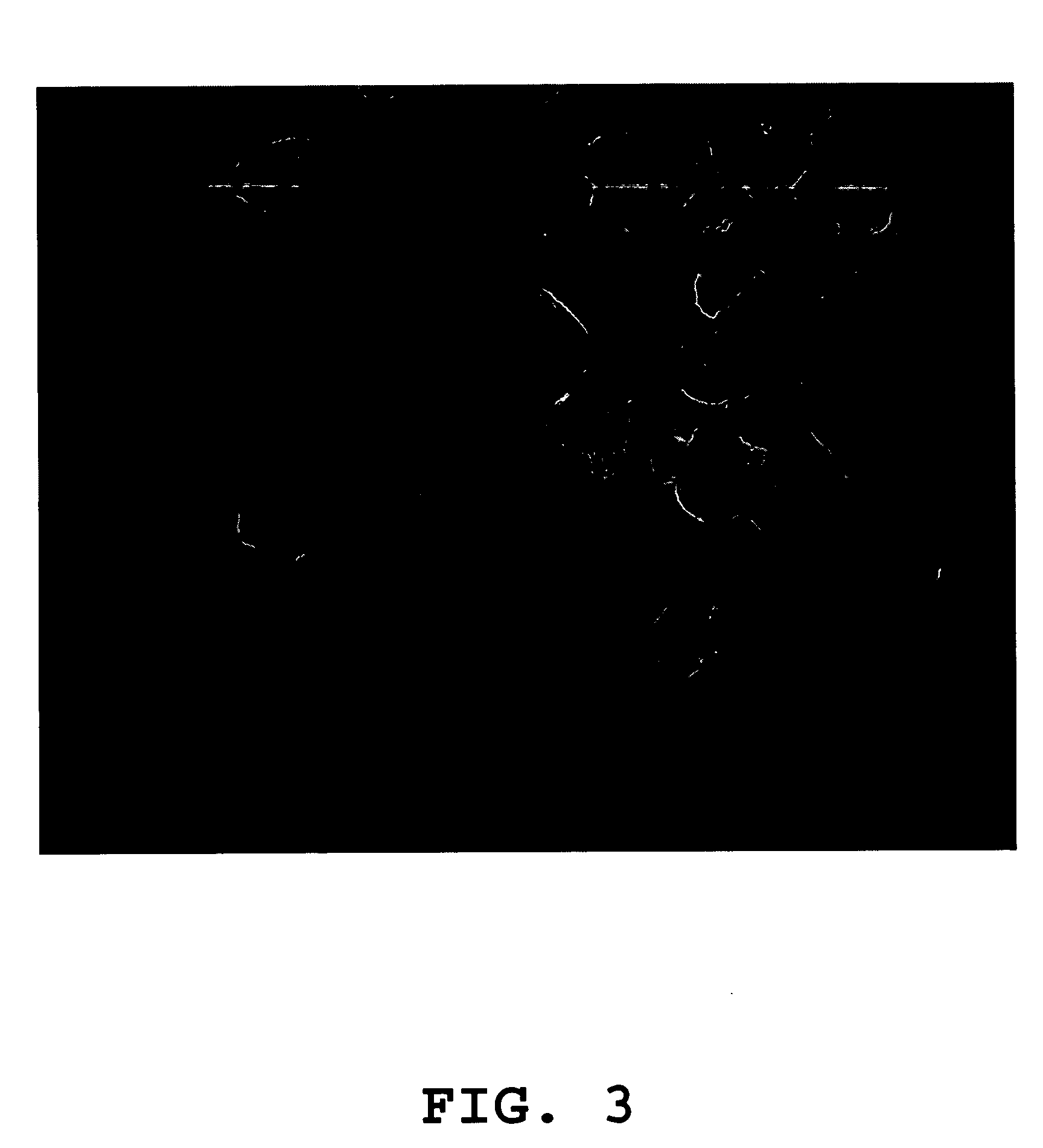 Novel human virus causing severe acute respiratory syndrome (SARS) and uses thereof