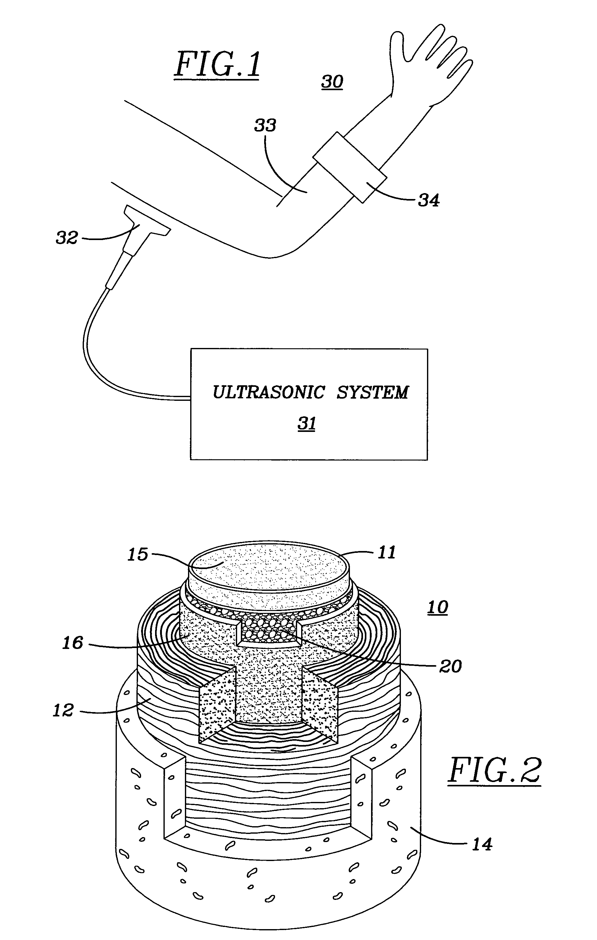 Method and diagnostic ultrasound apparatus for determining the condition of a person's artery or arteries