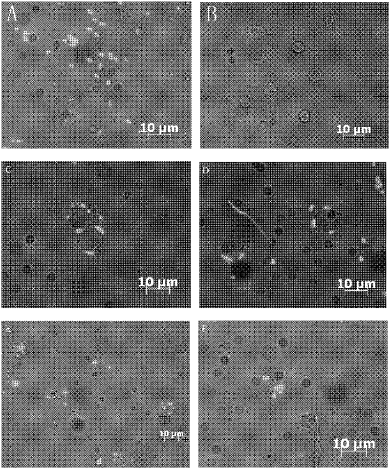 Method for identifying function and capability of cells for phagocytizing exogenous foreign bodies