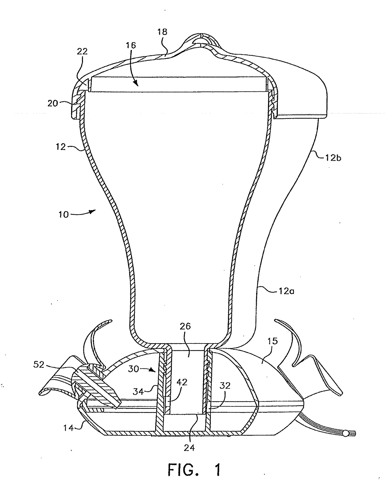 Top-fill hummingbird feeder with twist bottle valve