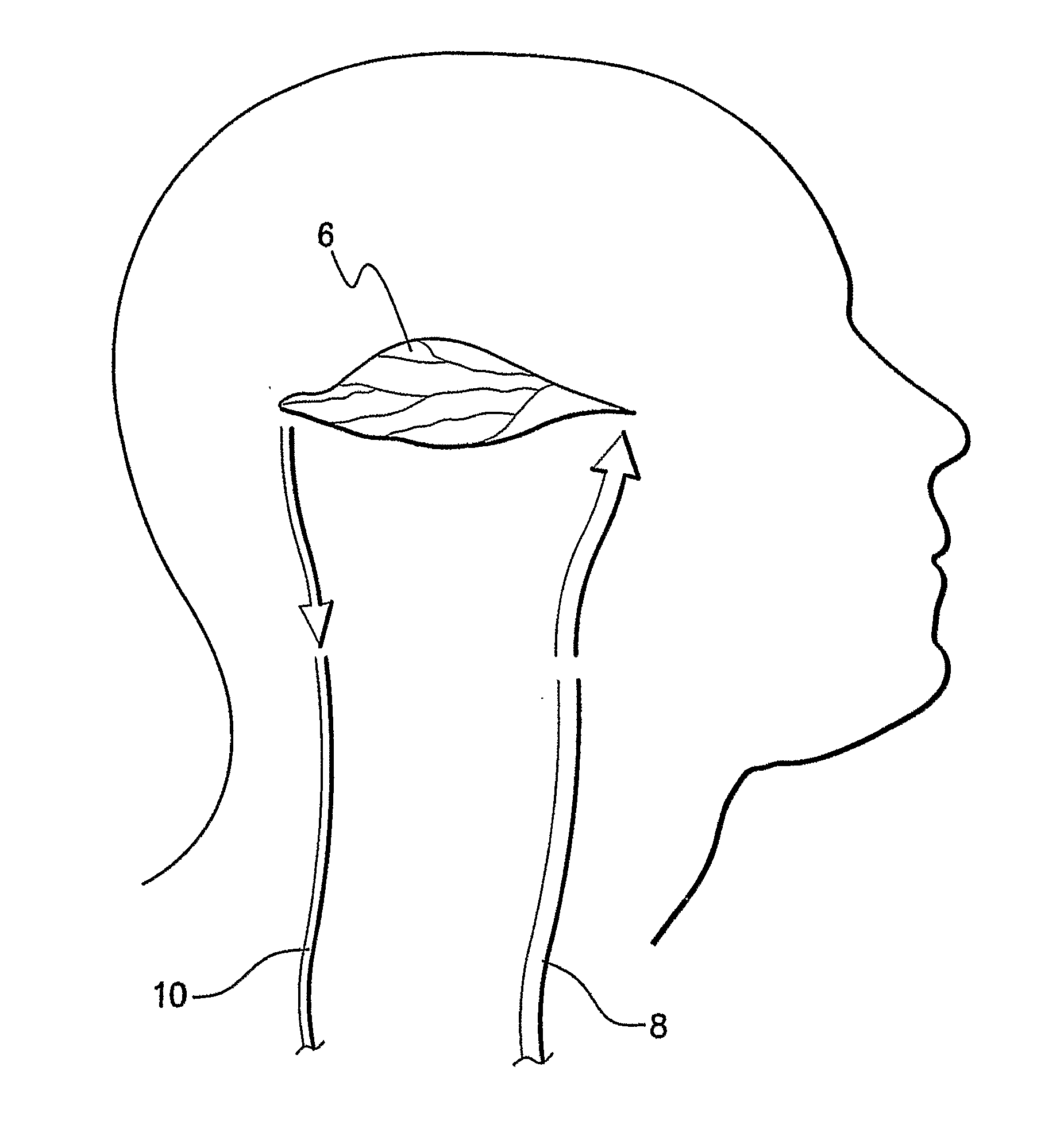 Method and system for mapping tissue status of acute stroke