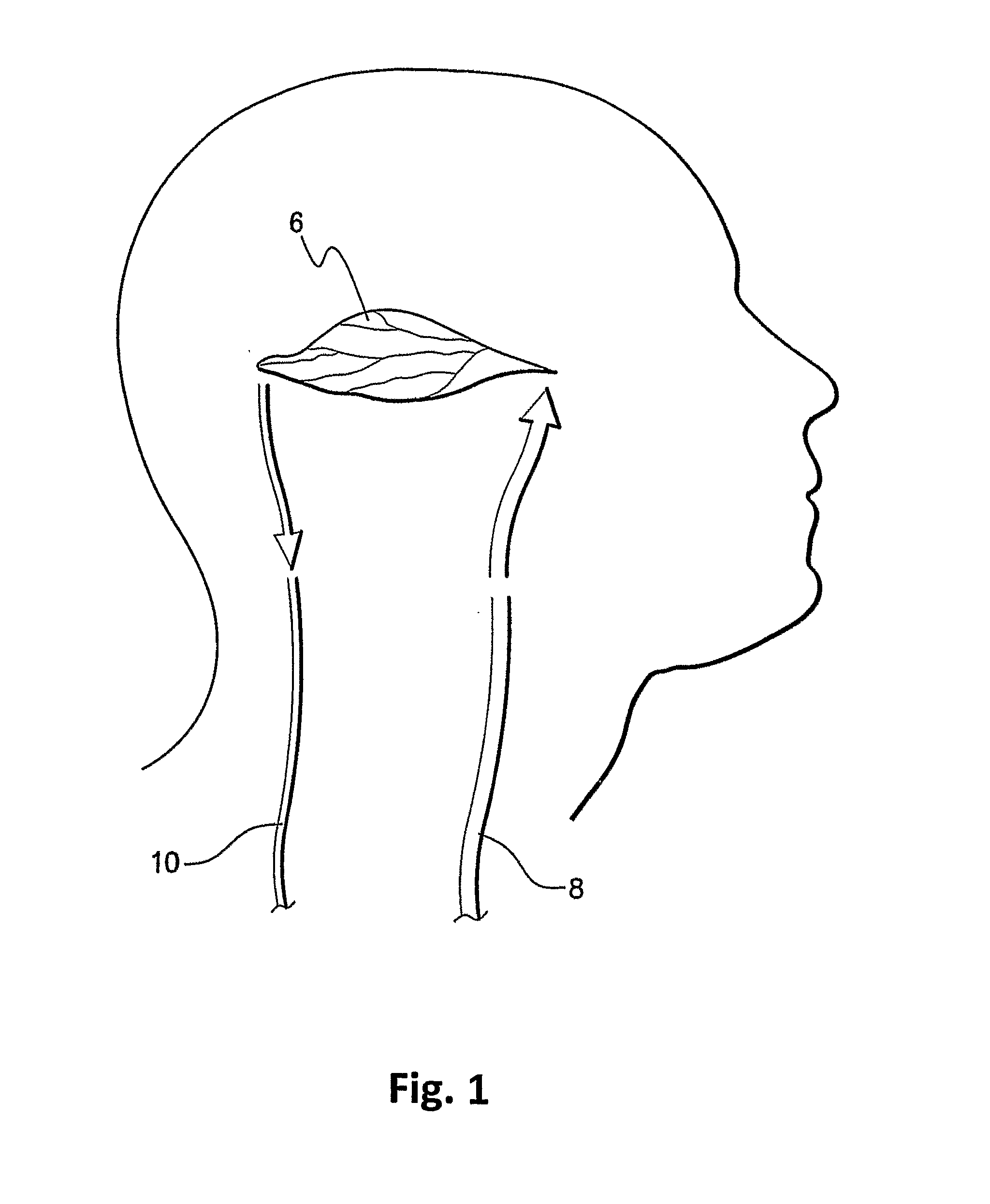 Method and system for mapping tissue status of acute stroke