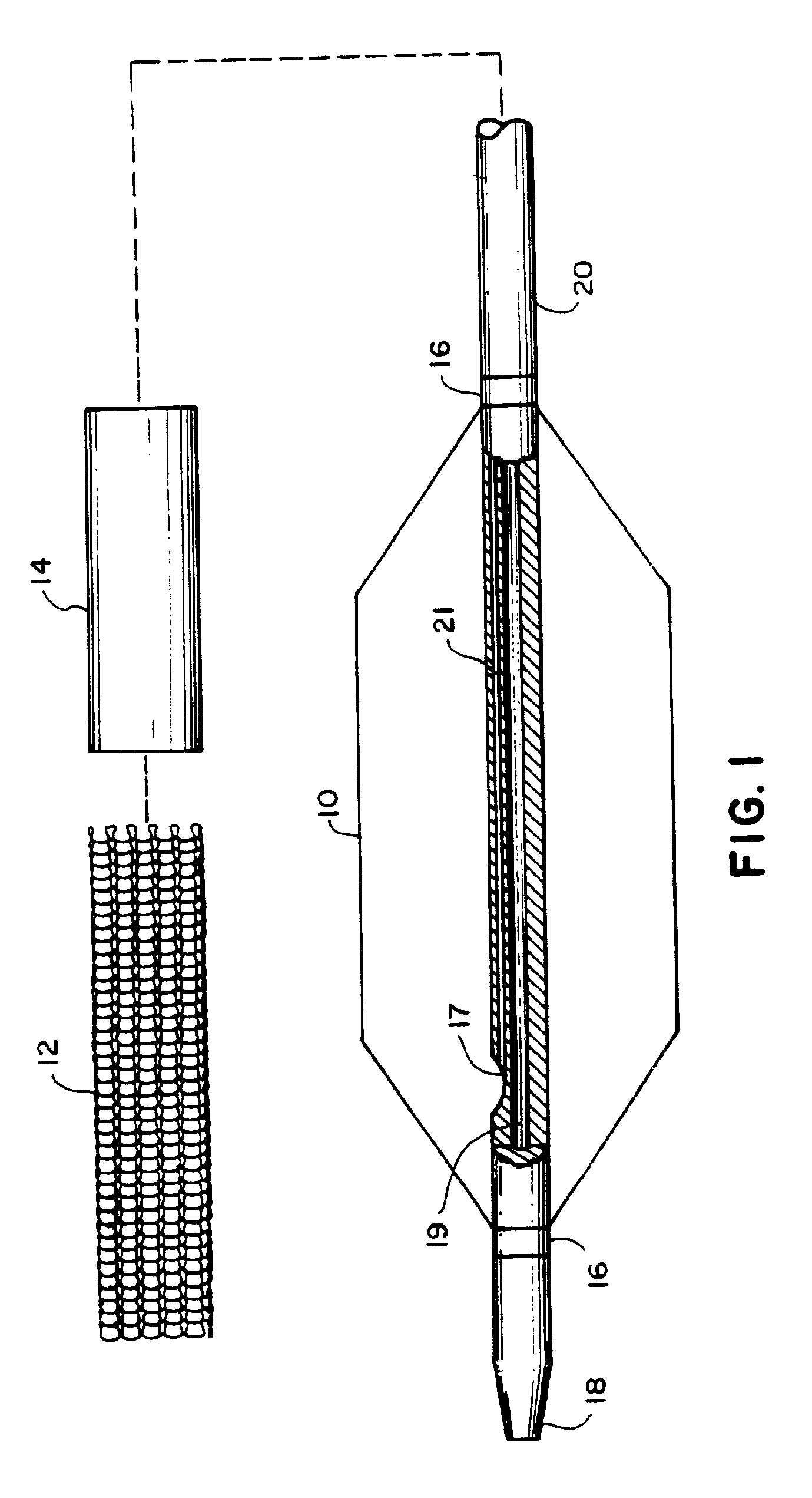 Controlled deployment of a medical device