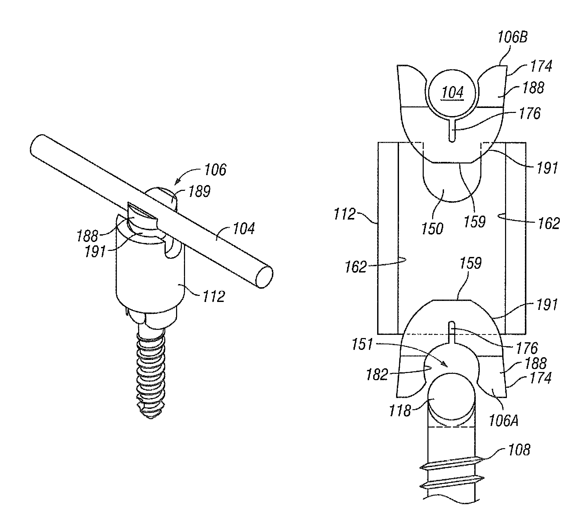 System and method for spine stabilization using resilient inserts