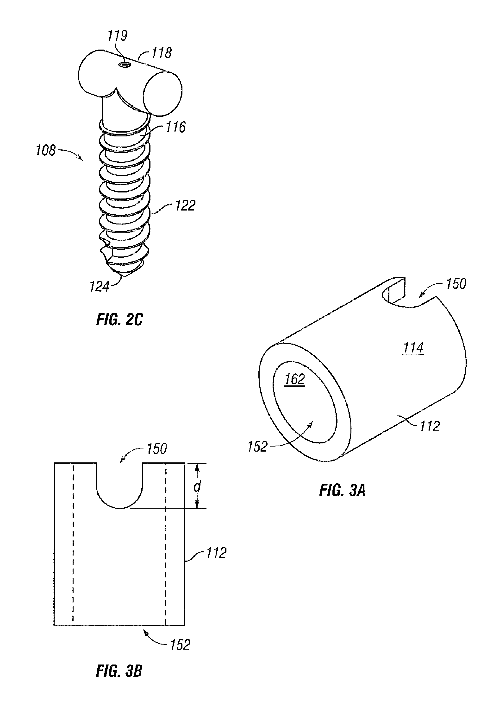 System and method for spine stabilization using resilient inserts