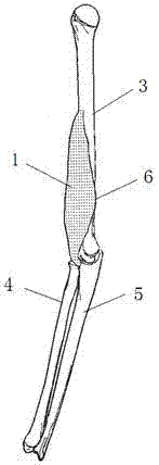 Fabrication method for skeleton and soft tissue X-ray developing image