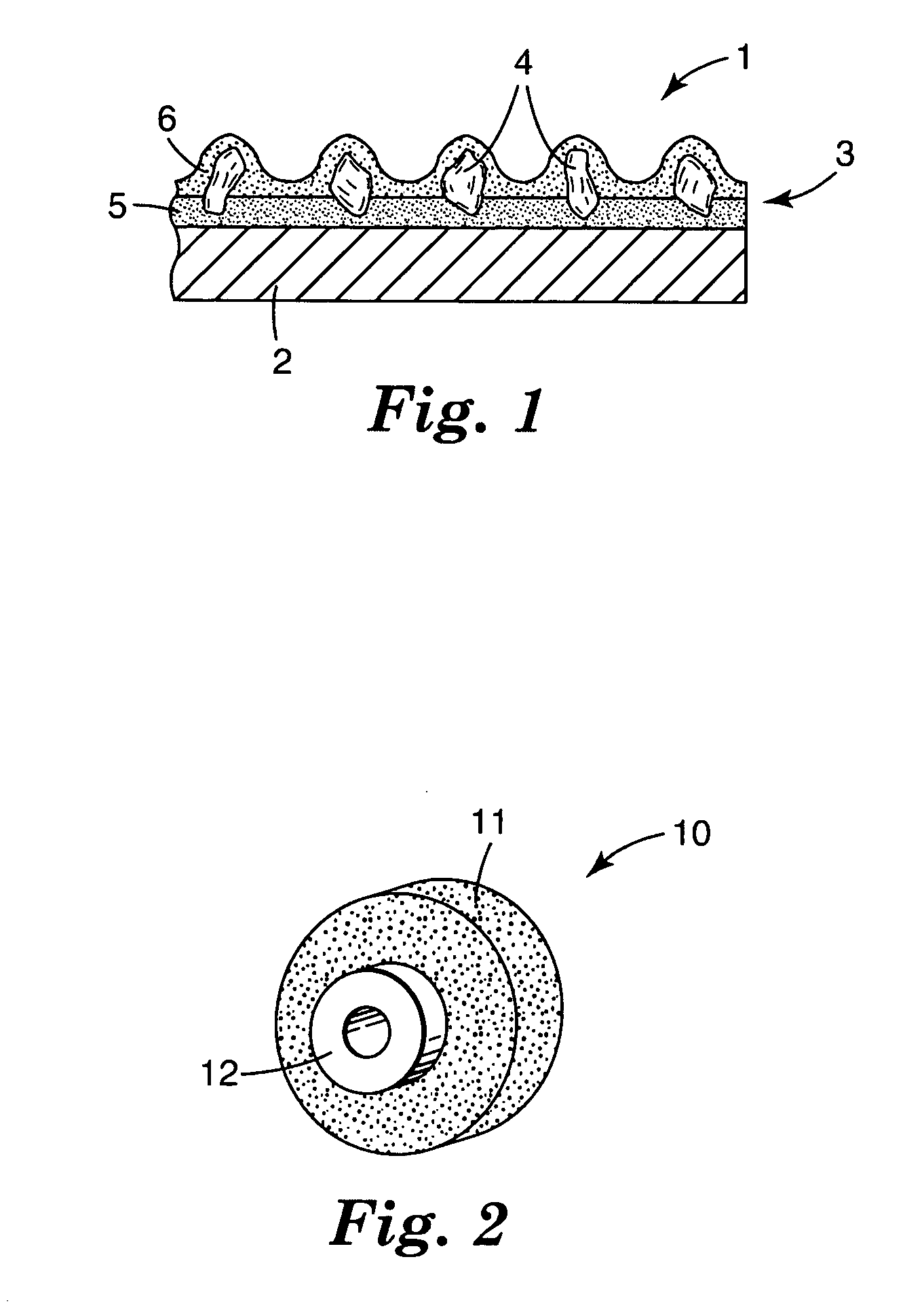 Composite particle comprising an abrasive grit