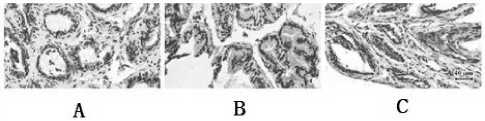 Application of arctiin in preparation of prostatic hyperplasia drugs