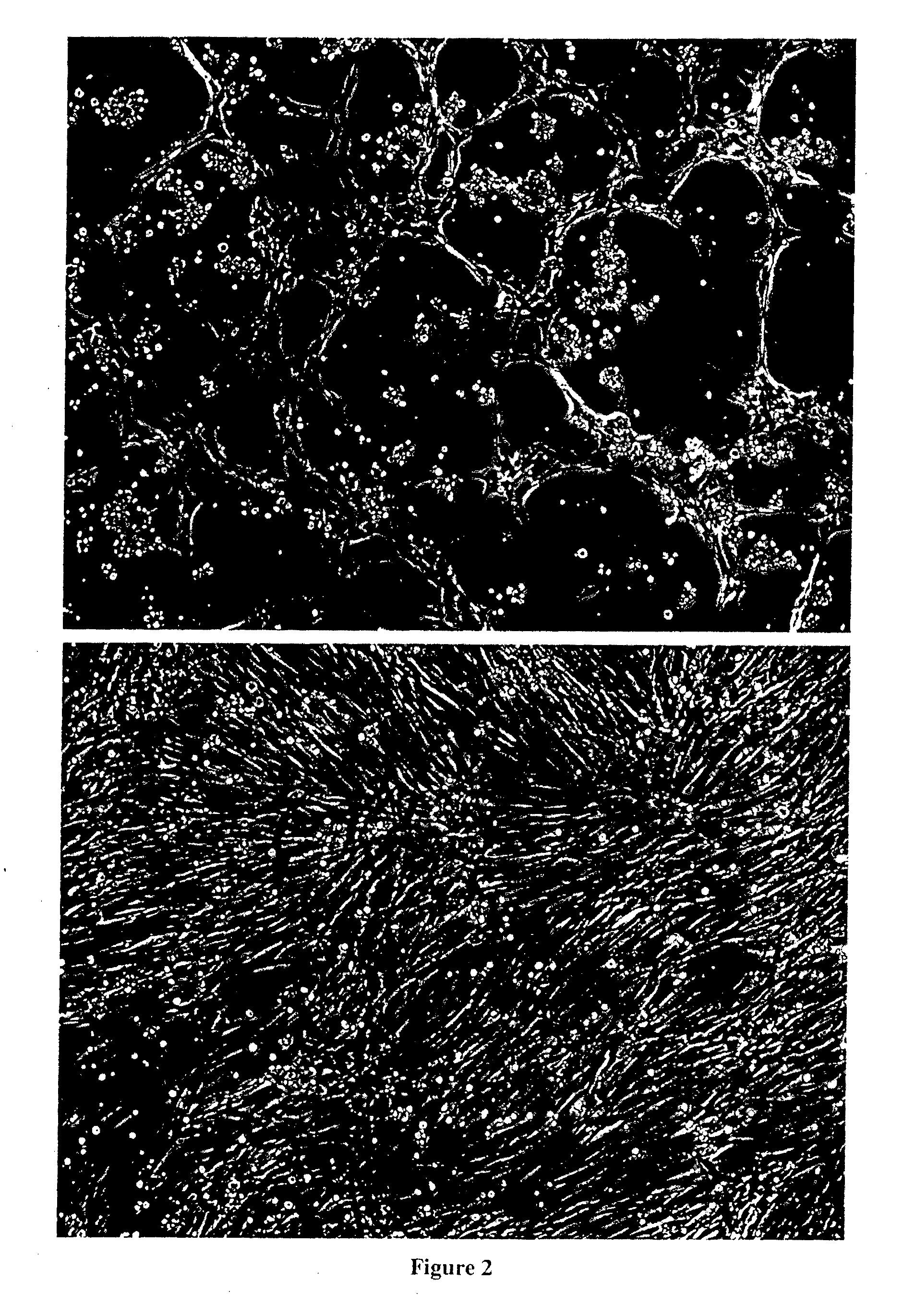 Therapeutics Using Adipose Cells and Cell Secretions