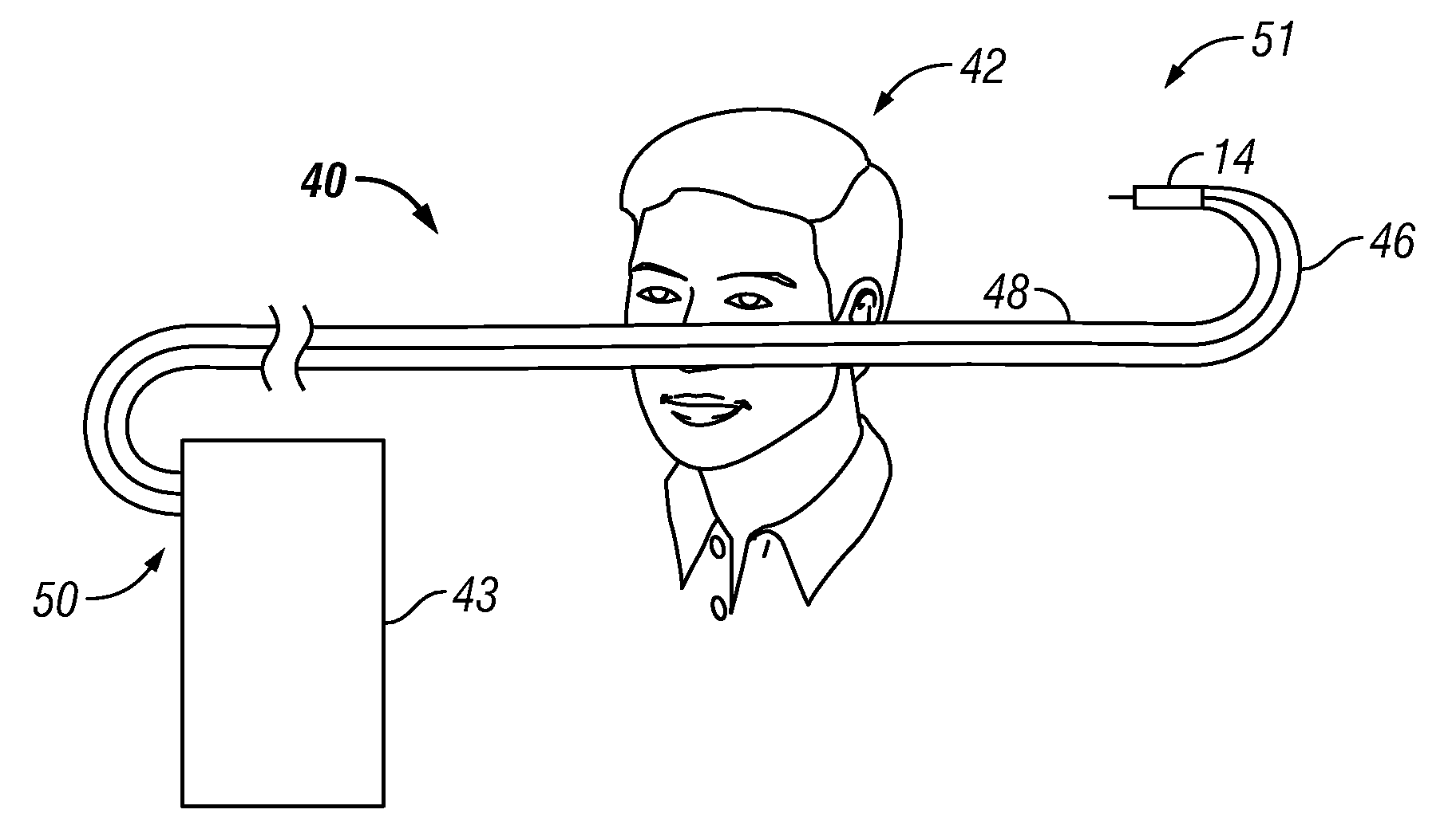 Varying Material Properties of a Single Fluidic Line in Ophthalmology Tubing