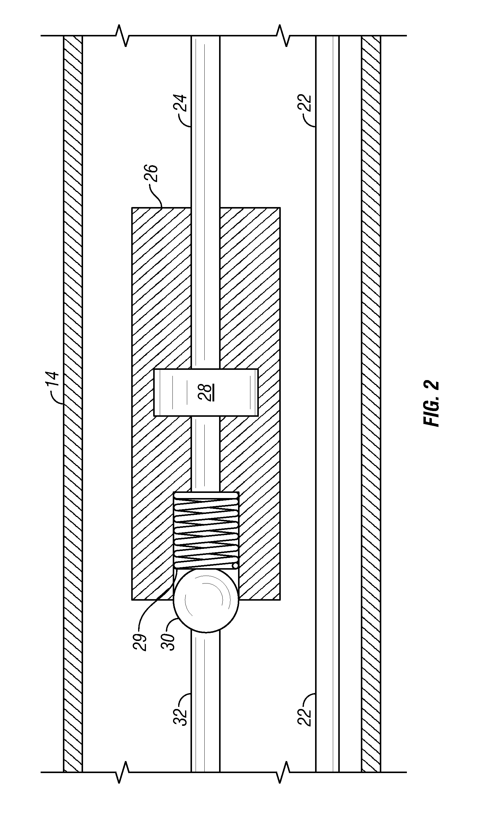 Varying Material Properties of a Single Fluidic Line in Ophthalmology Tubing