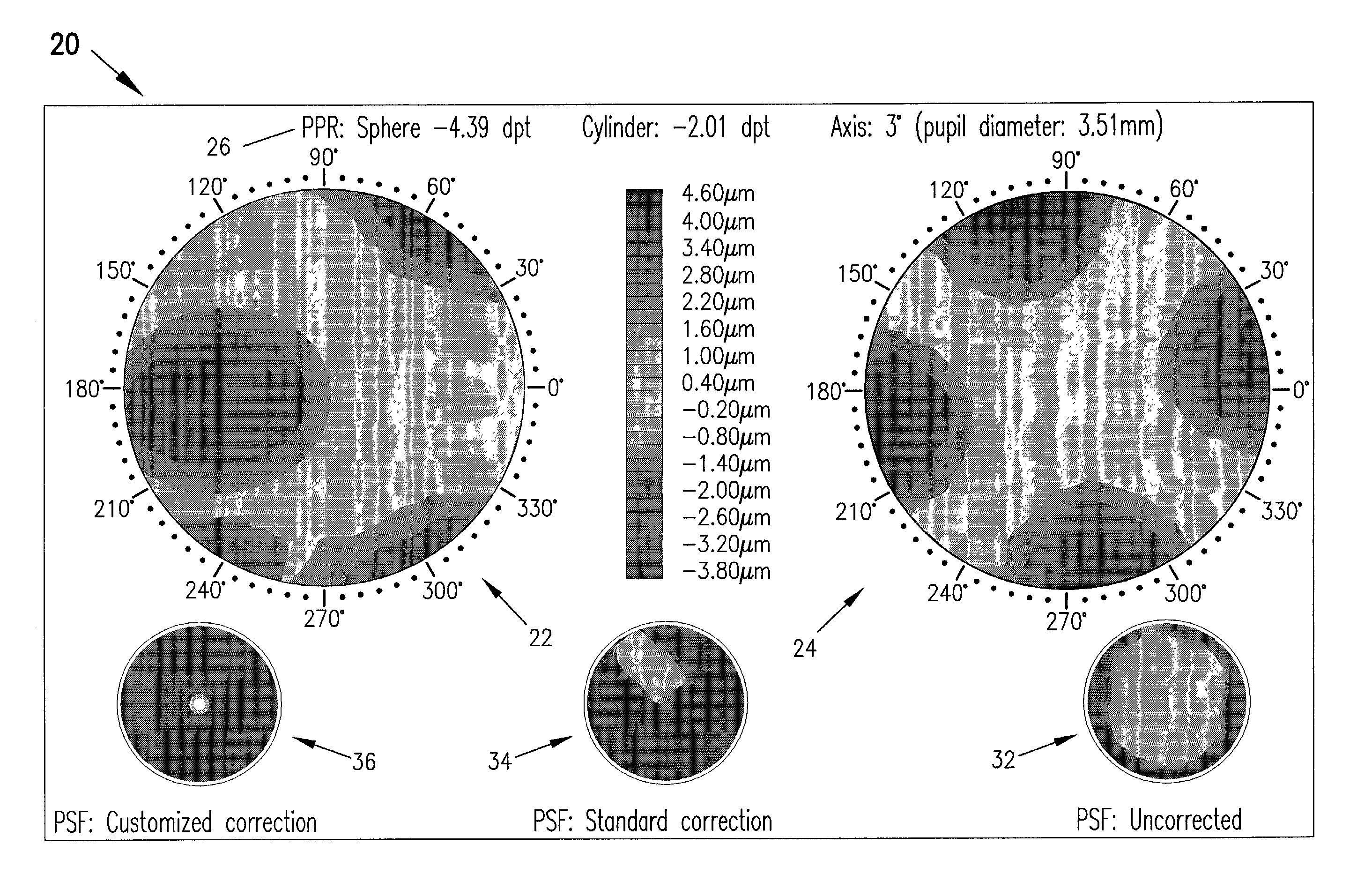 Objective manifest refraction