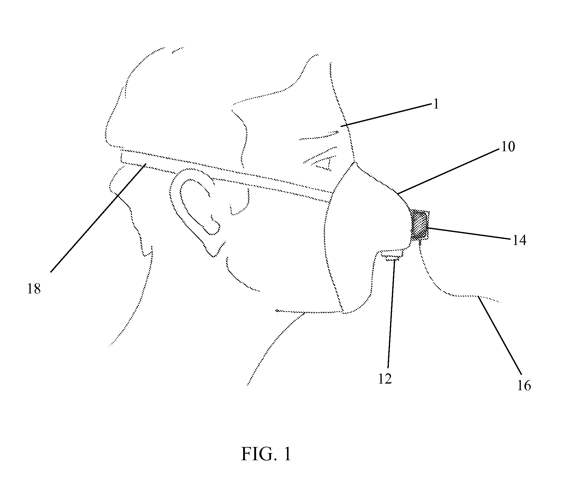 Monitor for measuring improvement in involuntary breathing