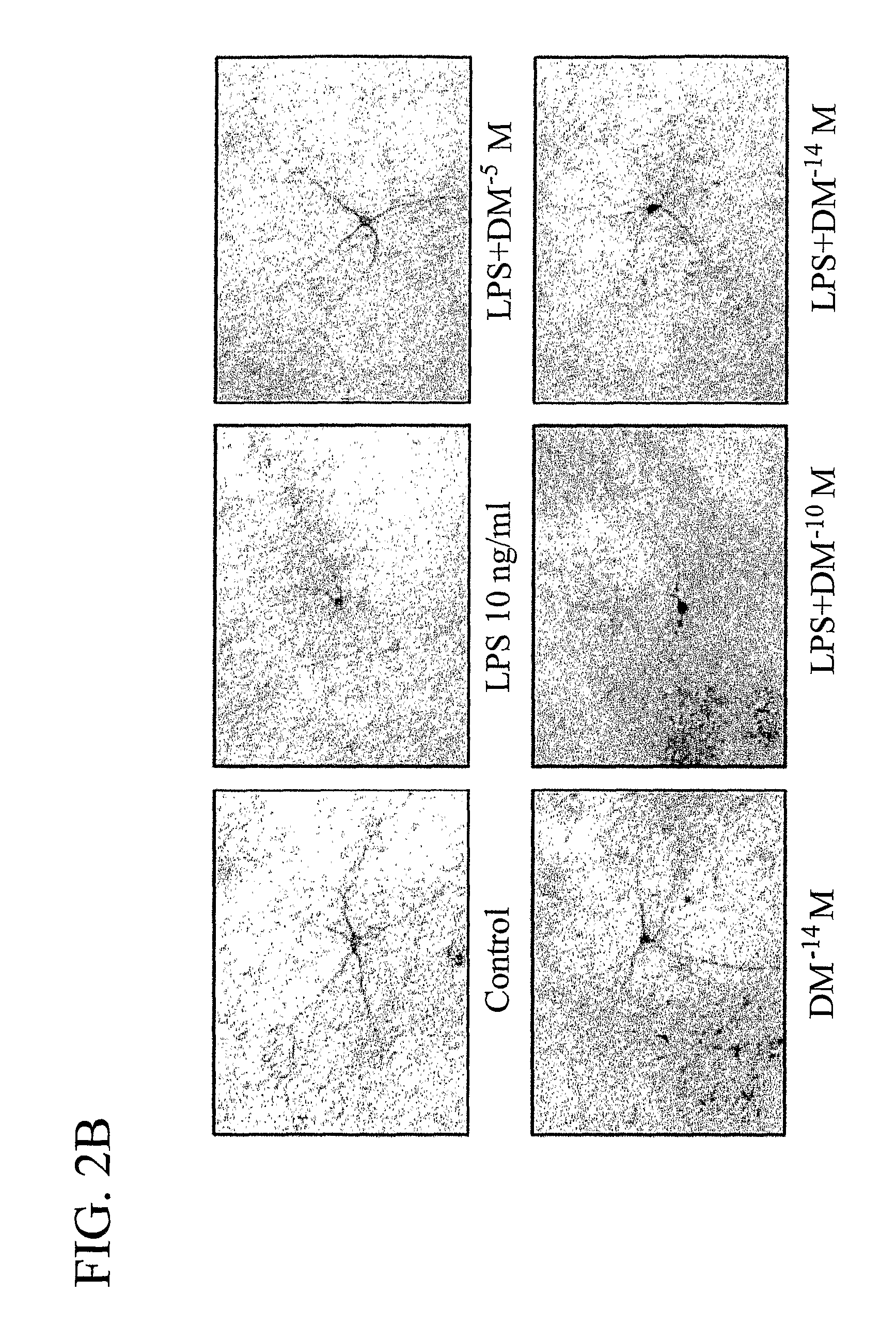 Methods related to the treatment of neurodegenerative and inflammatory conditions