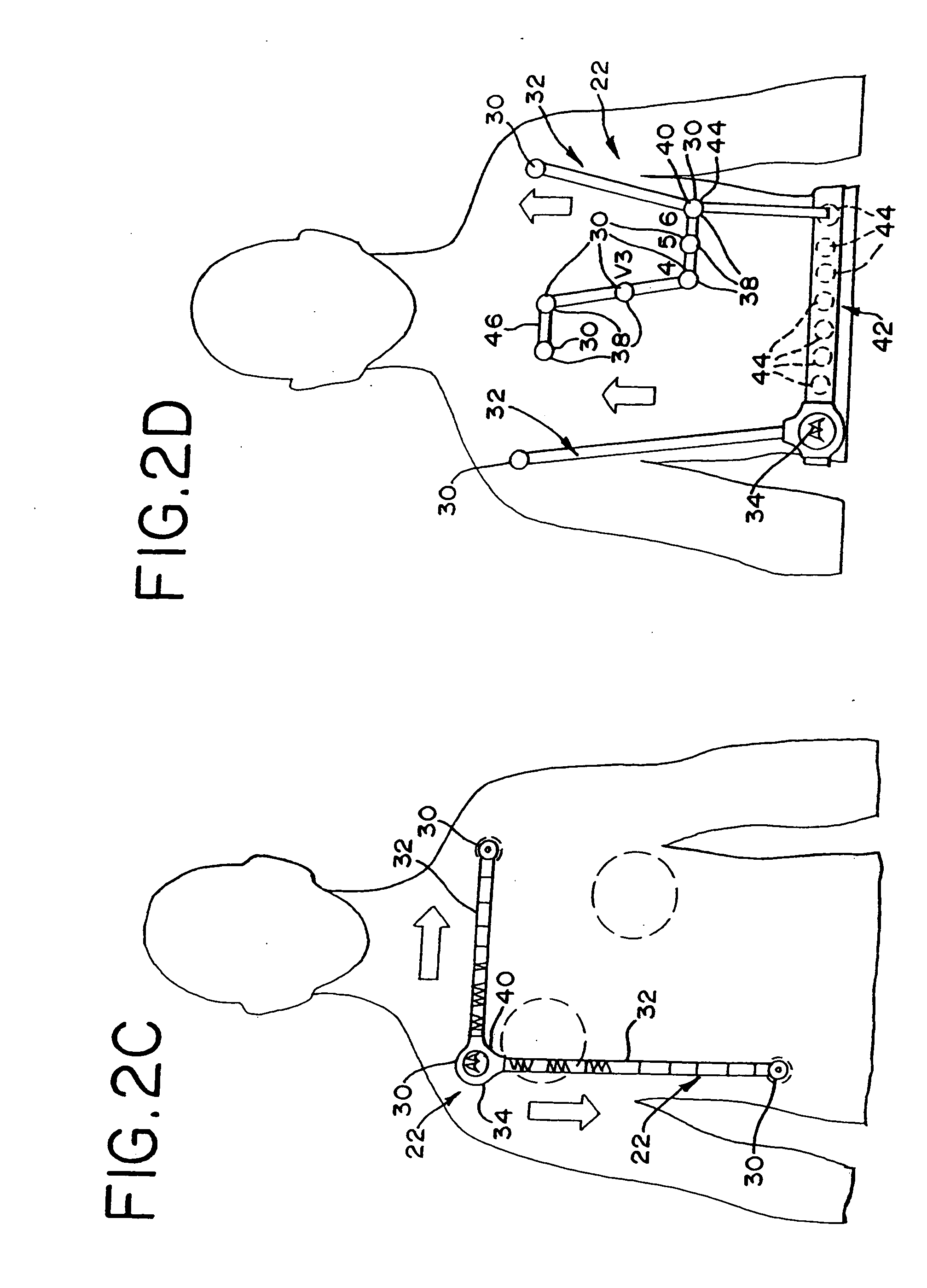 Wireless electrocardiograph system and method