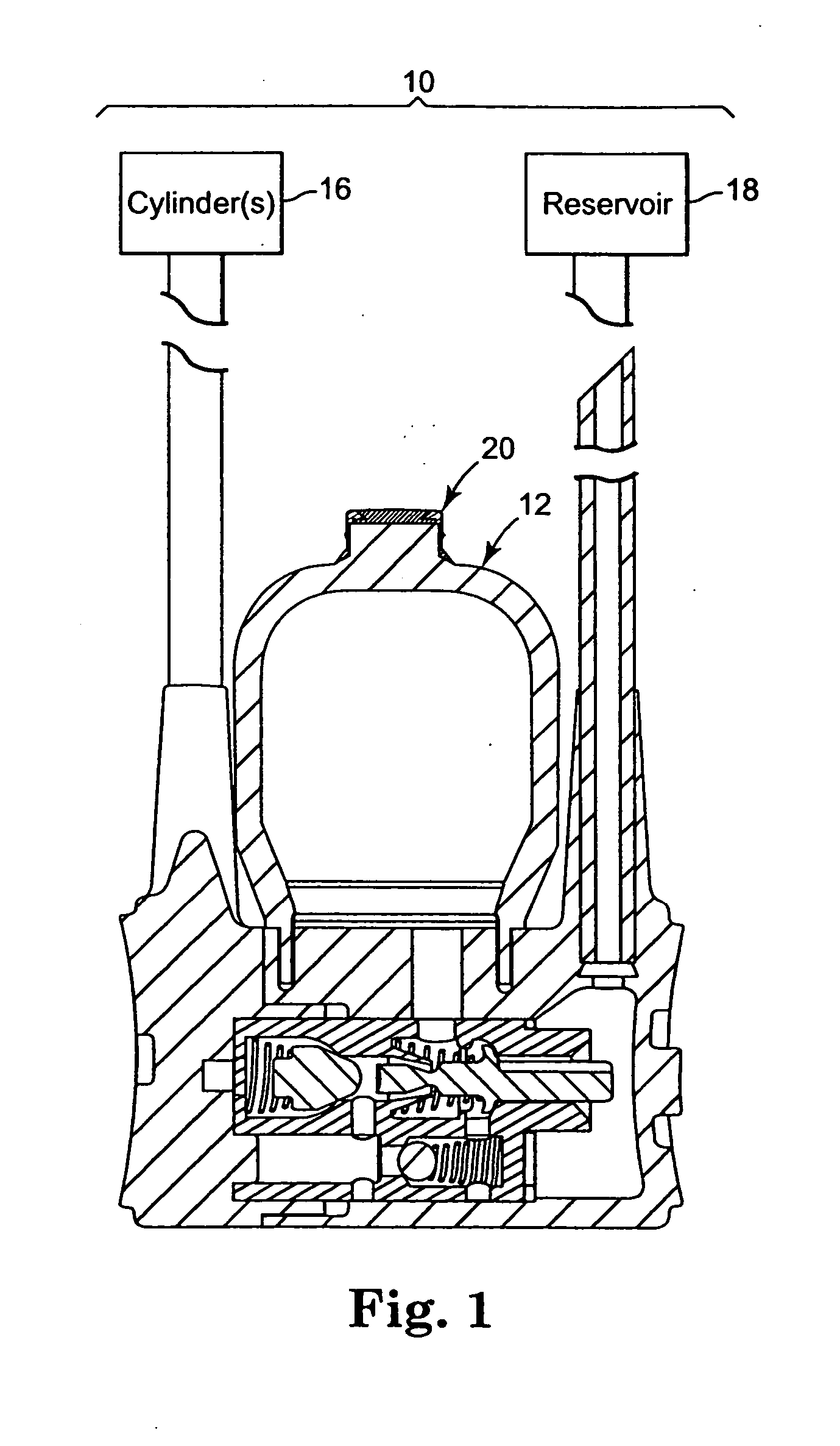 Implantable fluid transfer system