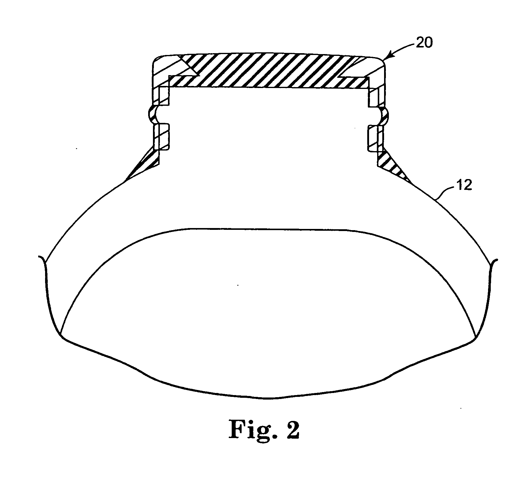 Implantable fluid transfer system