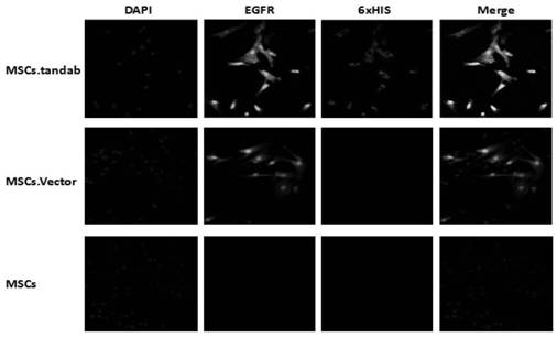 Mesenchymal stem cells (MSCs) secreting IL-6 antibody/CD20 antibody as well as construction method and application of MSCs