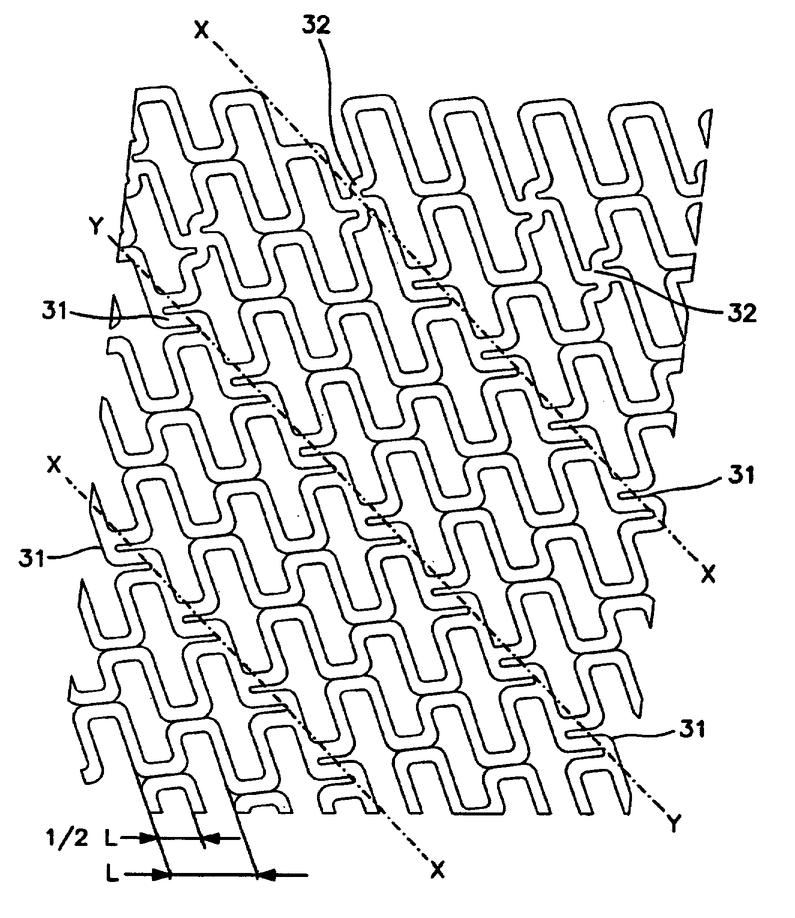 Expandable intraluminal endoprosthesis