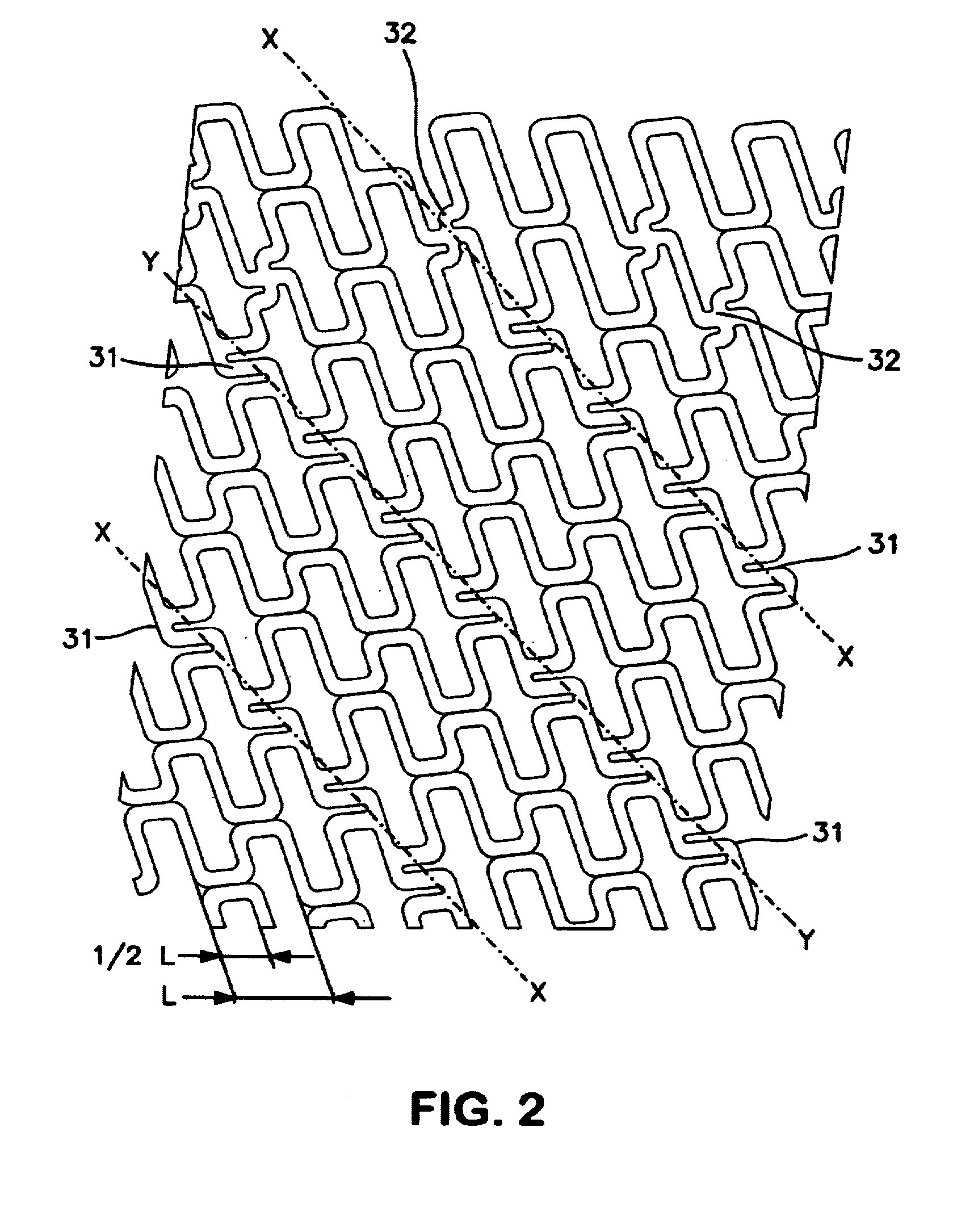 Expandable intraluminal endoprosthesis