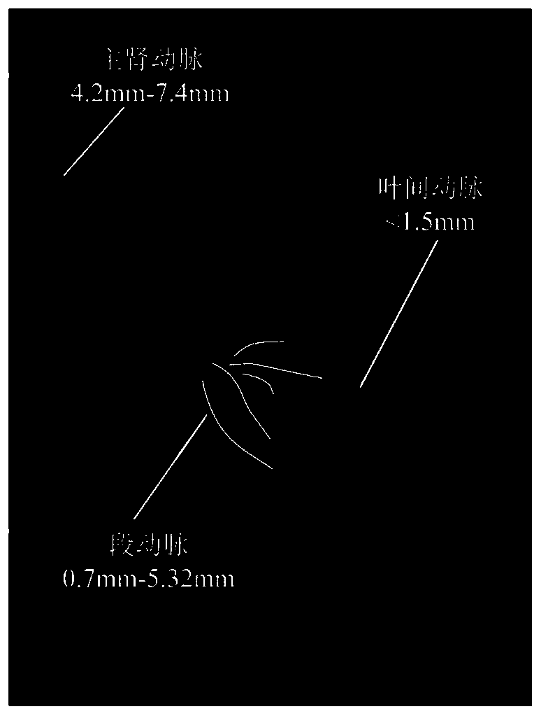 Semi-supervised renal artery segmentation method based on dense bias network and auto-encoder