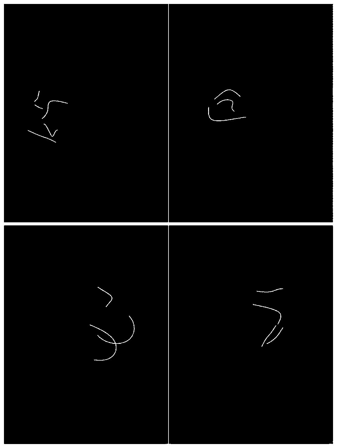 Semi-supervised renal artery segmentation method based on dense bias network and auto-encoder