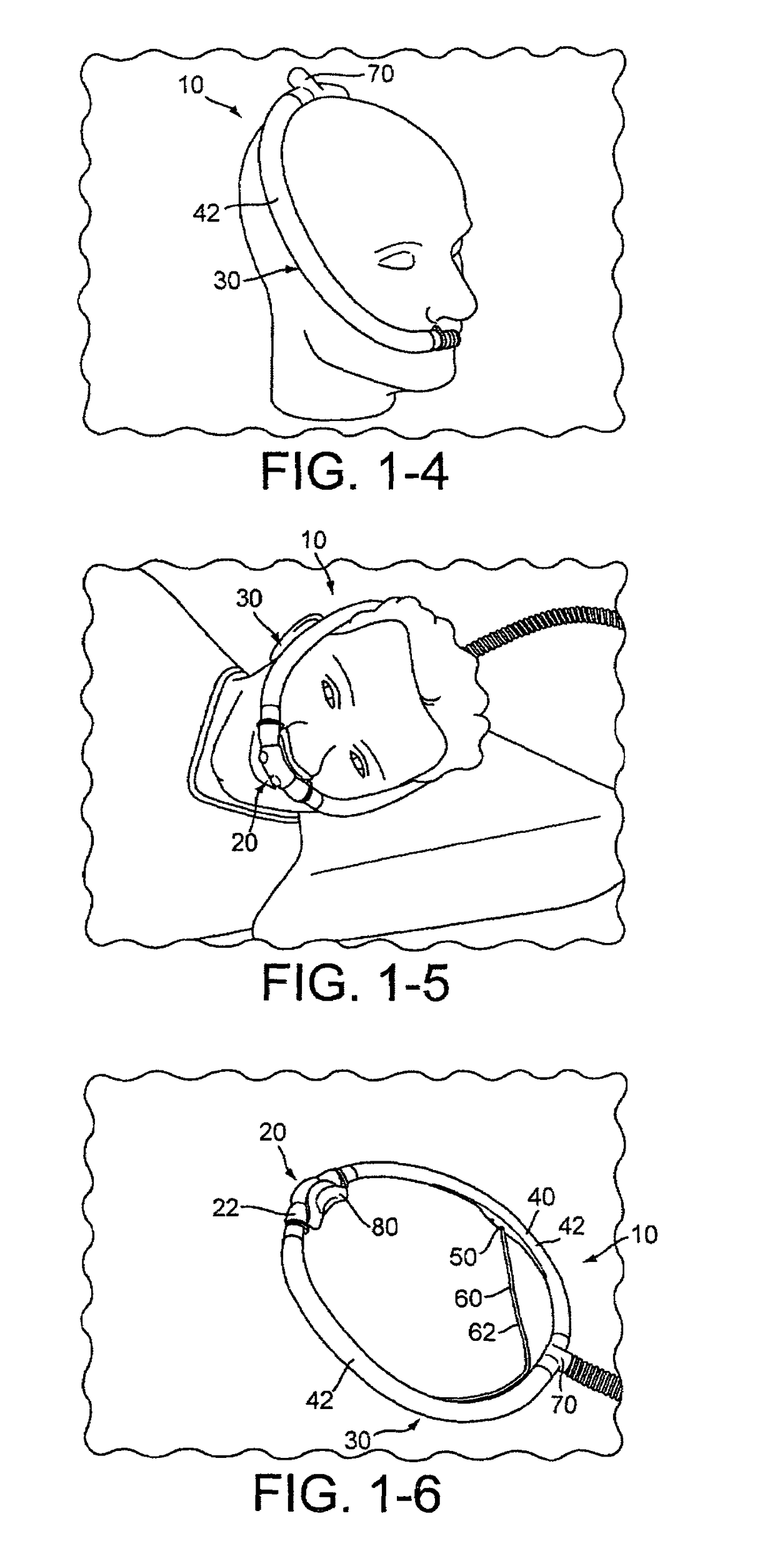 Delivery of respiratory therapy with nasal interface