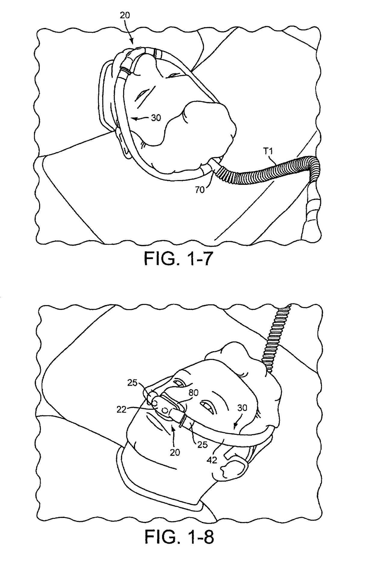 Delivery of respiratory therapy with nasal interface