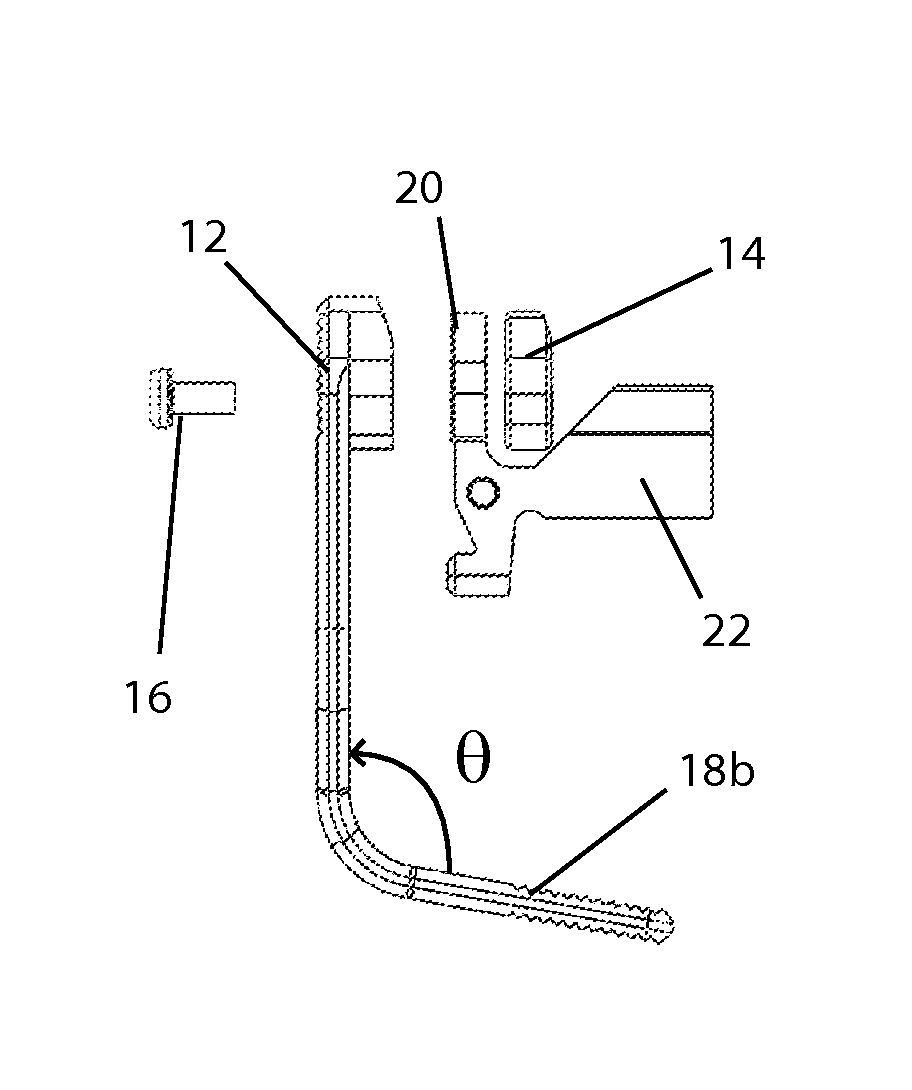 Battery assist device