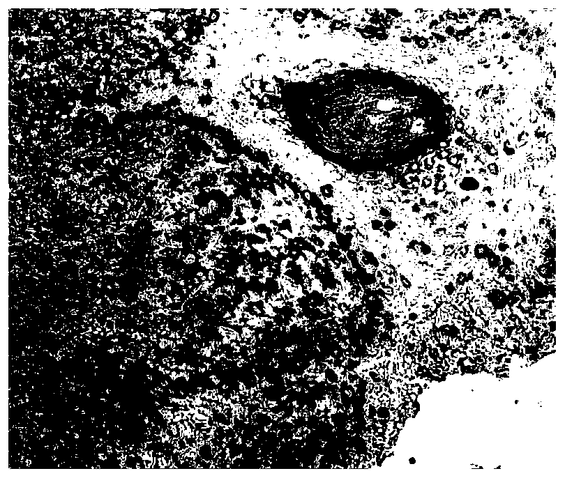 Immunohistochemical staining kit containing pigment tissues and staining method