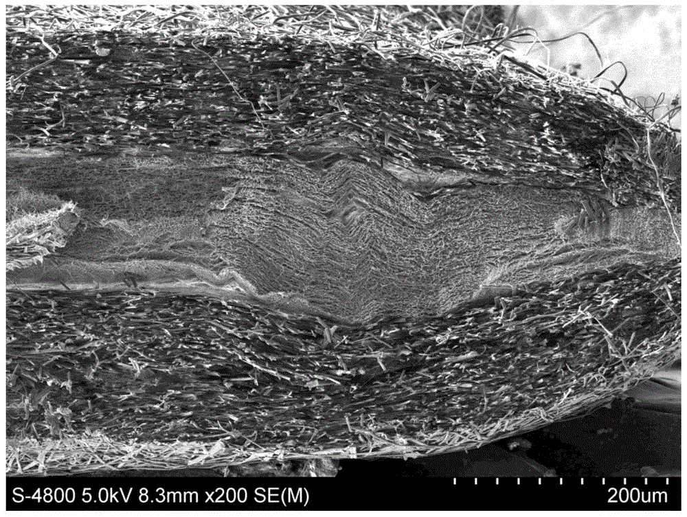 Doxycycline-hyclate-carried GTR/GBR composite membrane and preparation method thereof