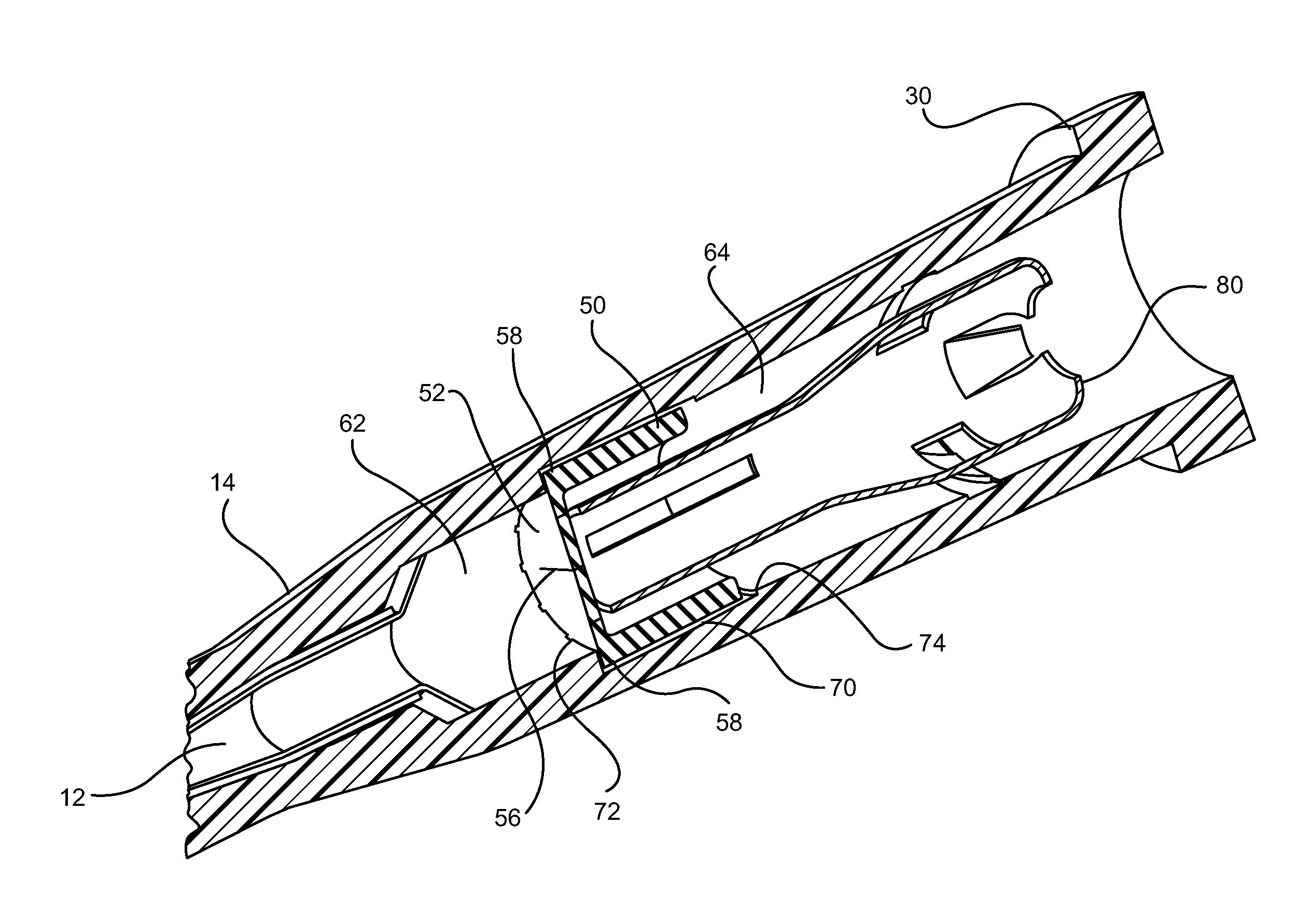 Systems and methods to compensate for compression forces in an intravascular device