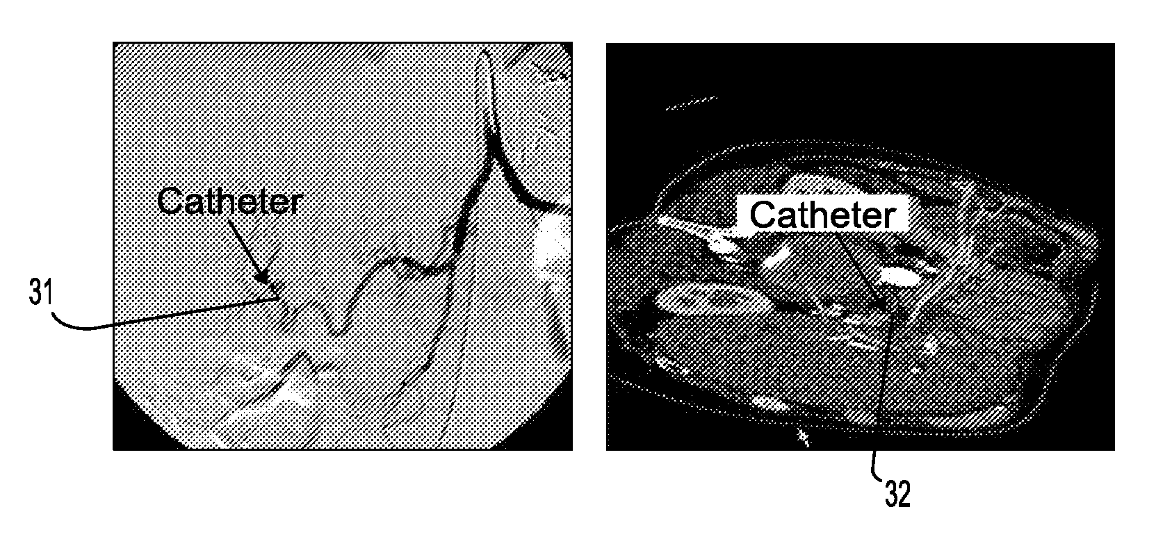 System and method for robust 2D-3D image registration