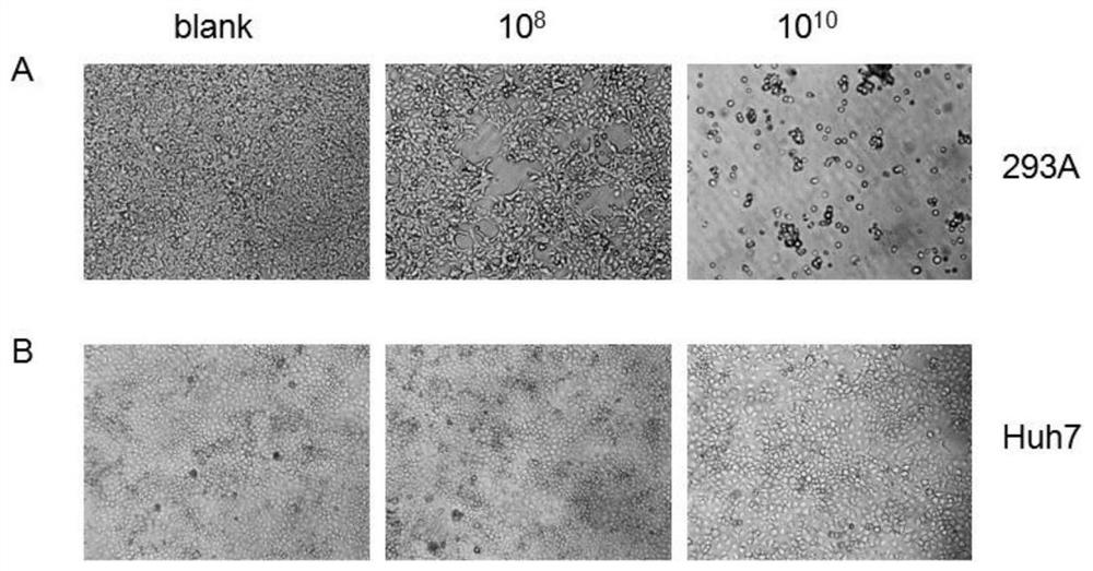 Recombinant chimpanzee source adenovirus for expressing rabies virus G protein and preparation method of recombinant chimpanzee source adenovirus