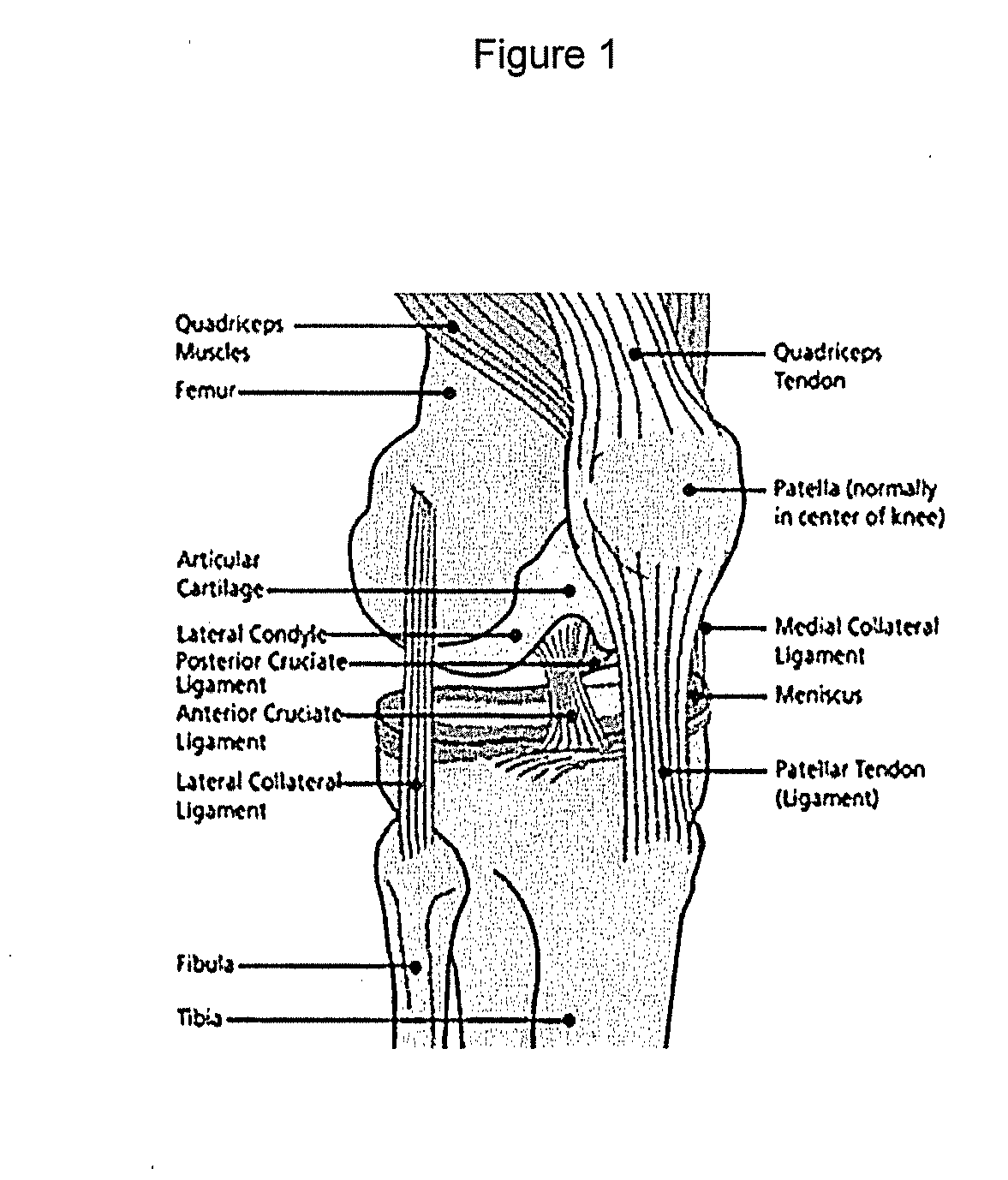 Methods of manufacturing cartilage products