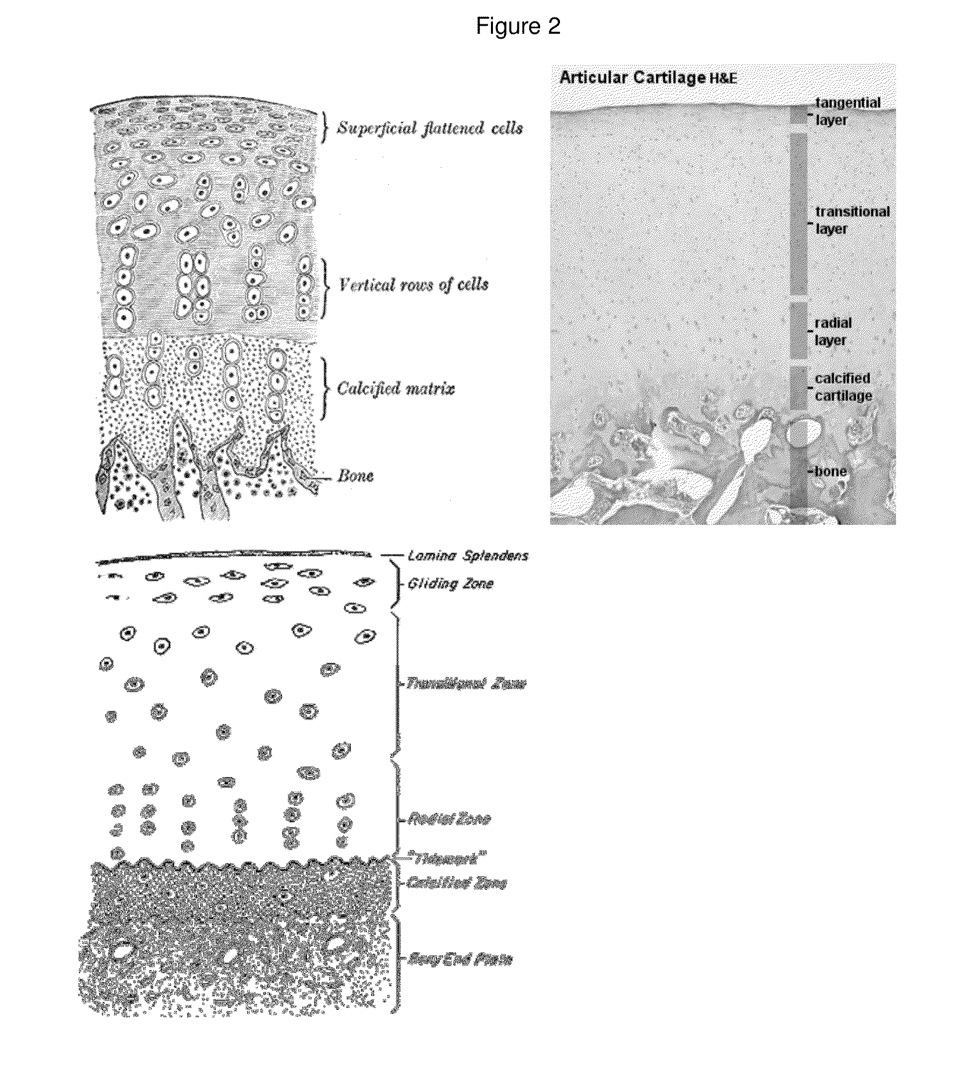 Methods of manufacturing cartilage products